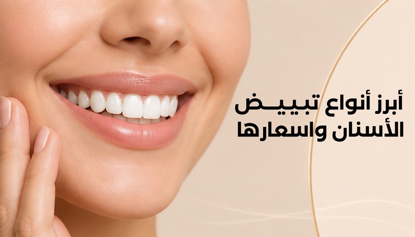 أفضل طرق تبييض الأسنان وأسعارها