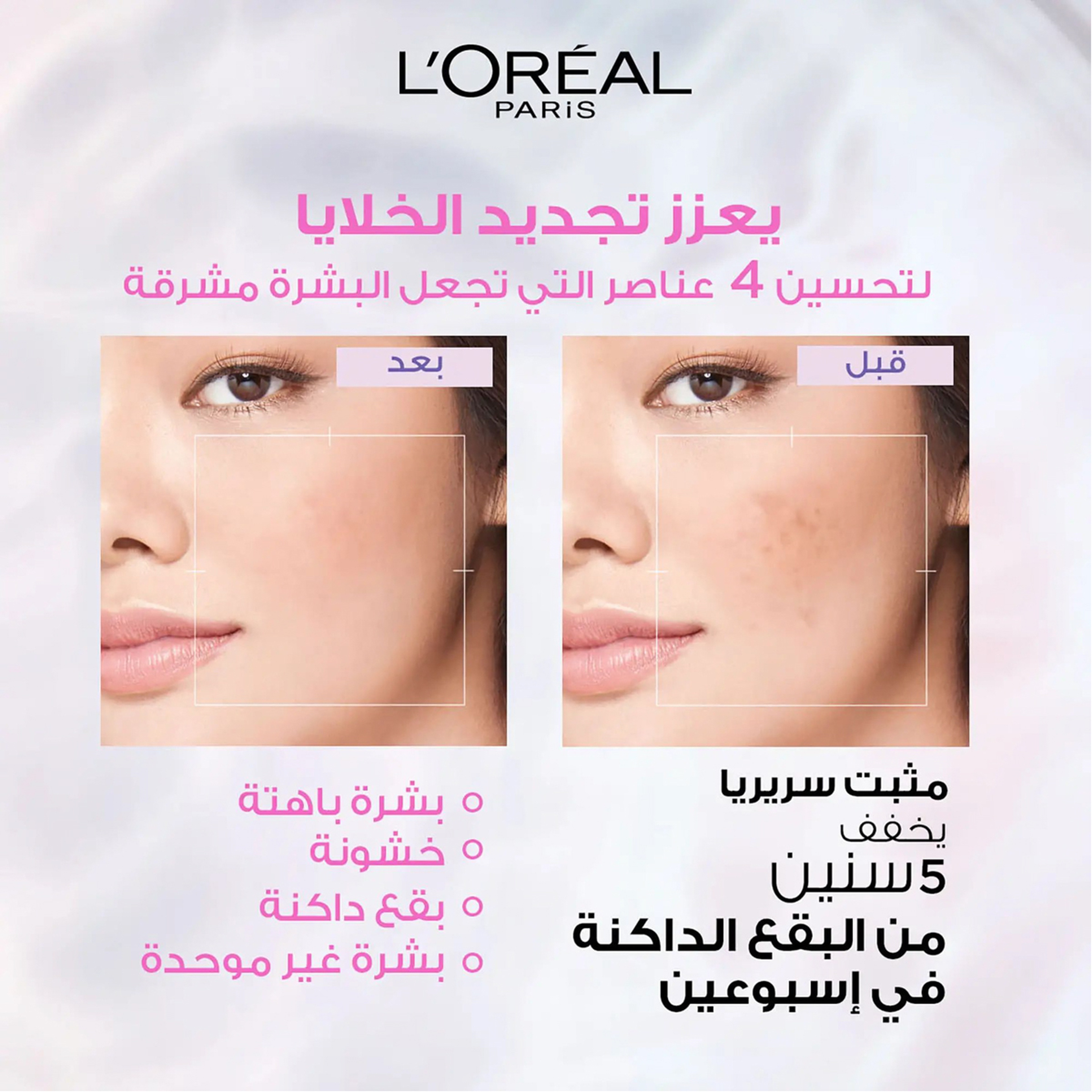 Loreal Paris Glycolic Bright & Anti Dark Spot Face Serum, Instant Glow