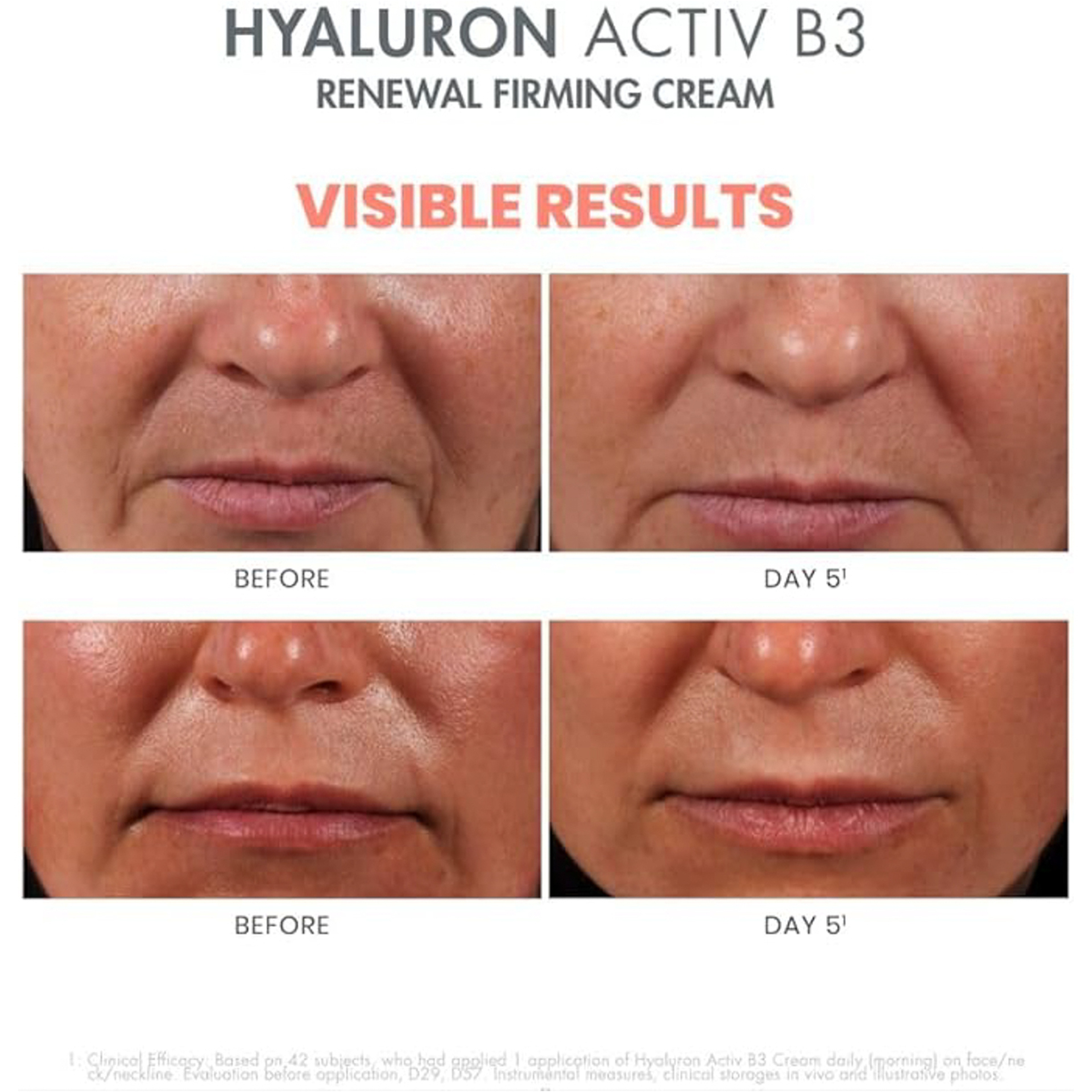 افين كريم هيالورون اكتيف بي 3 لتجديد الخلايا 50 مل