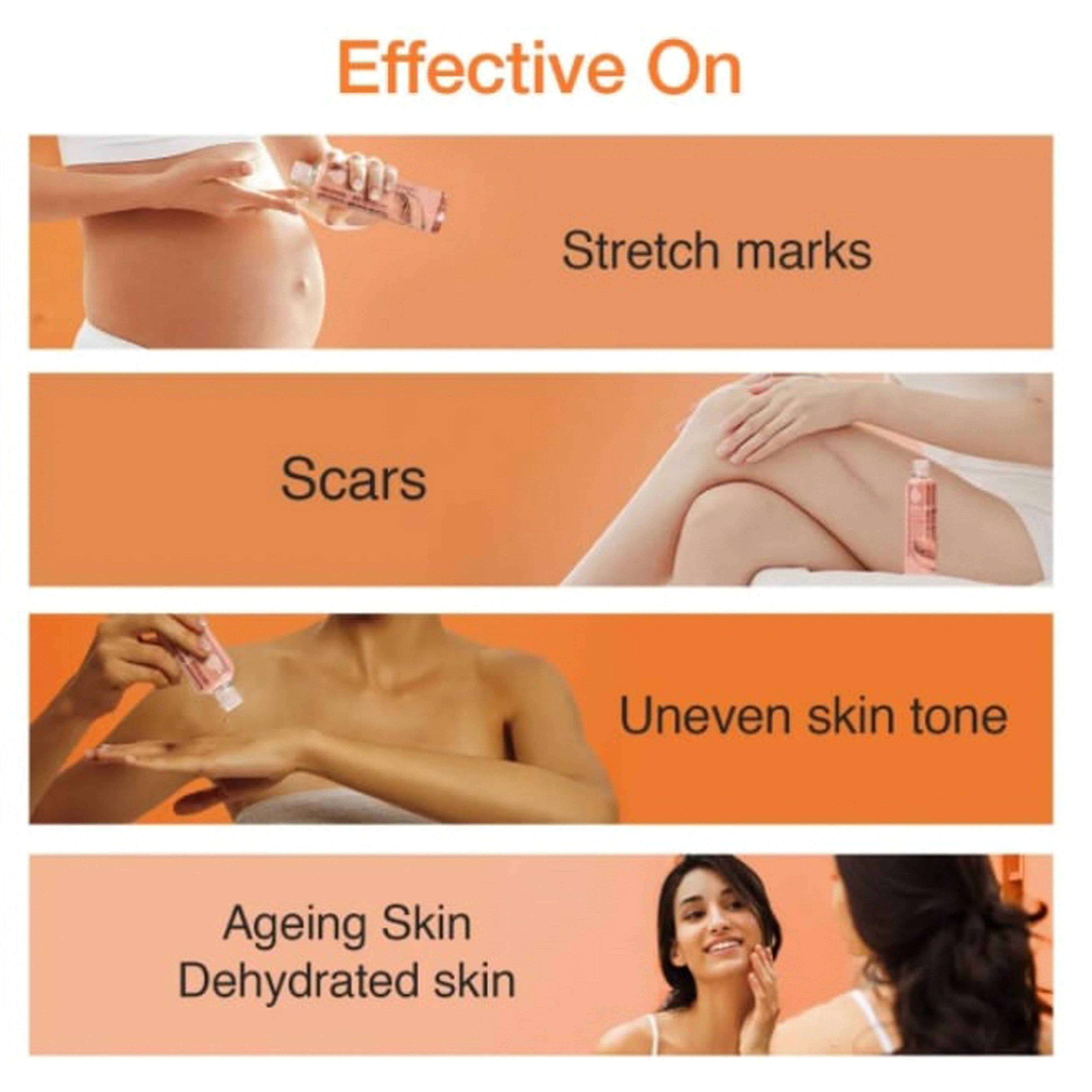 زيت بيو أويل للعناية بالبشرة - 200 مل