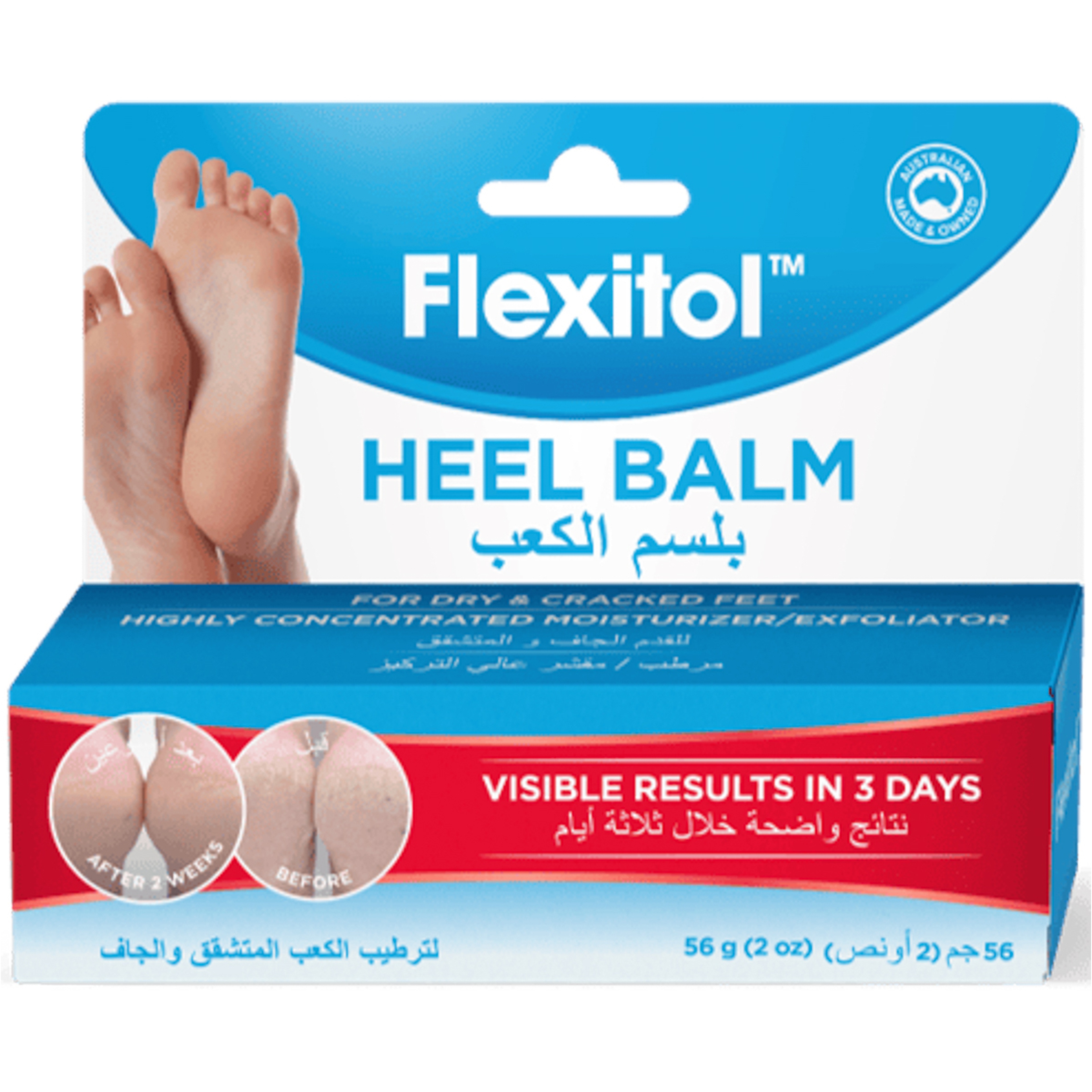 مرهم للكعبين 56 جم