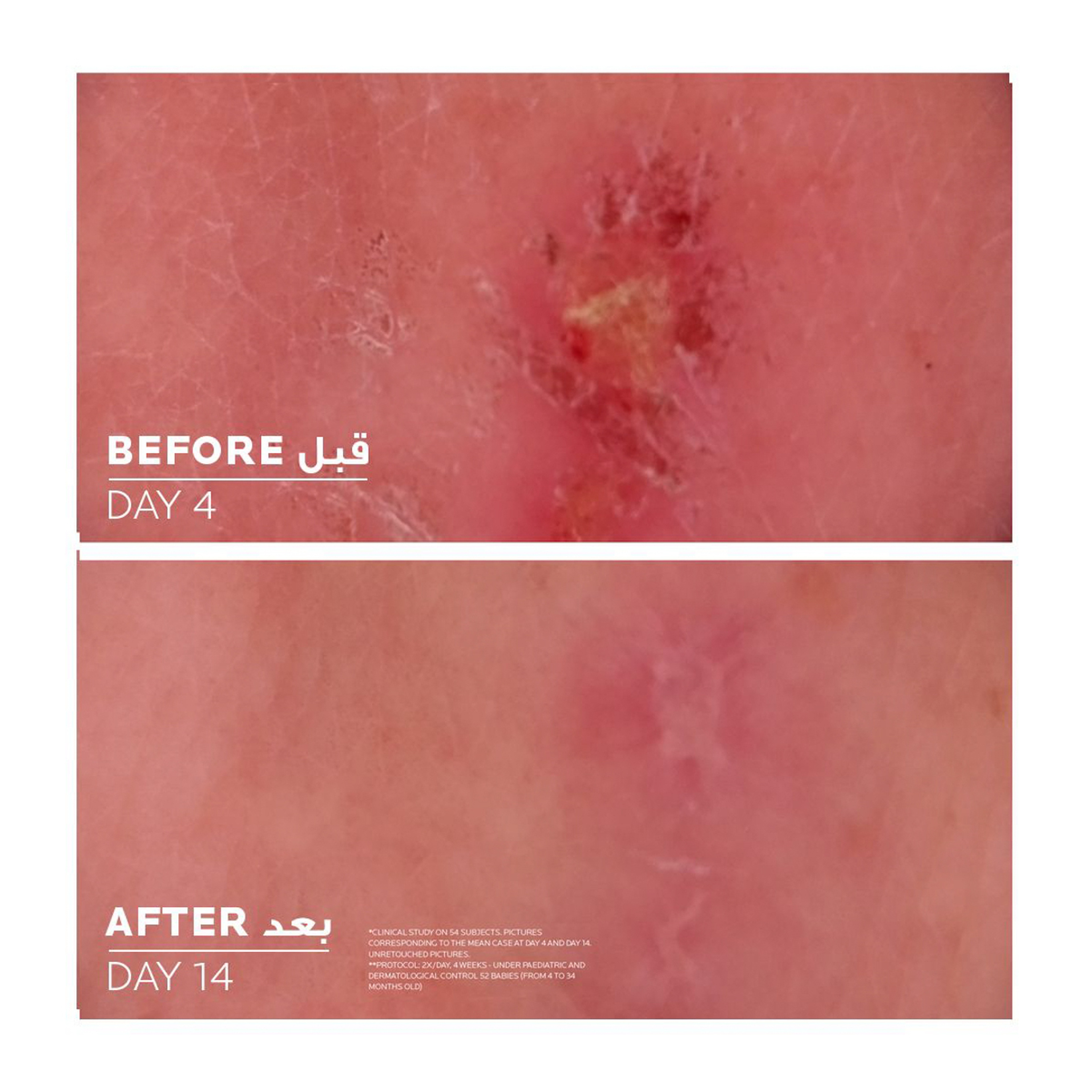 La Roche-Posy Cicaplast Baume B5+ So.Balm 100ml