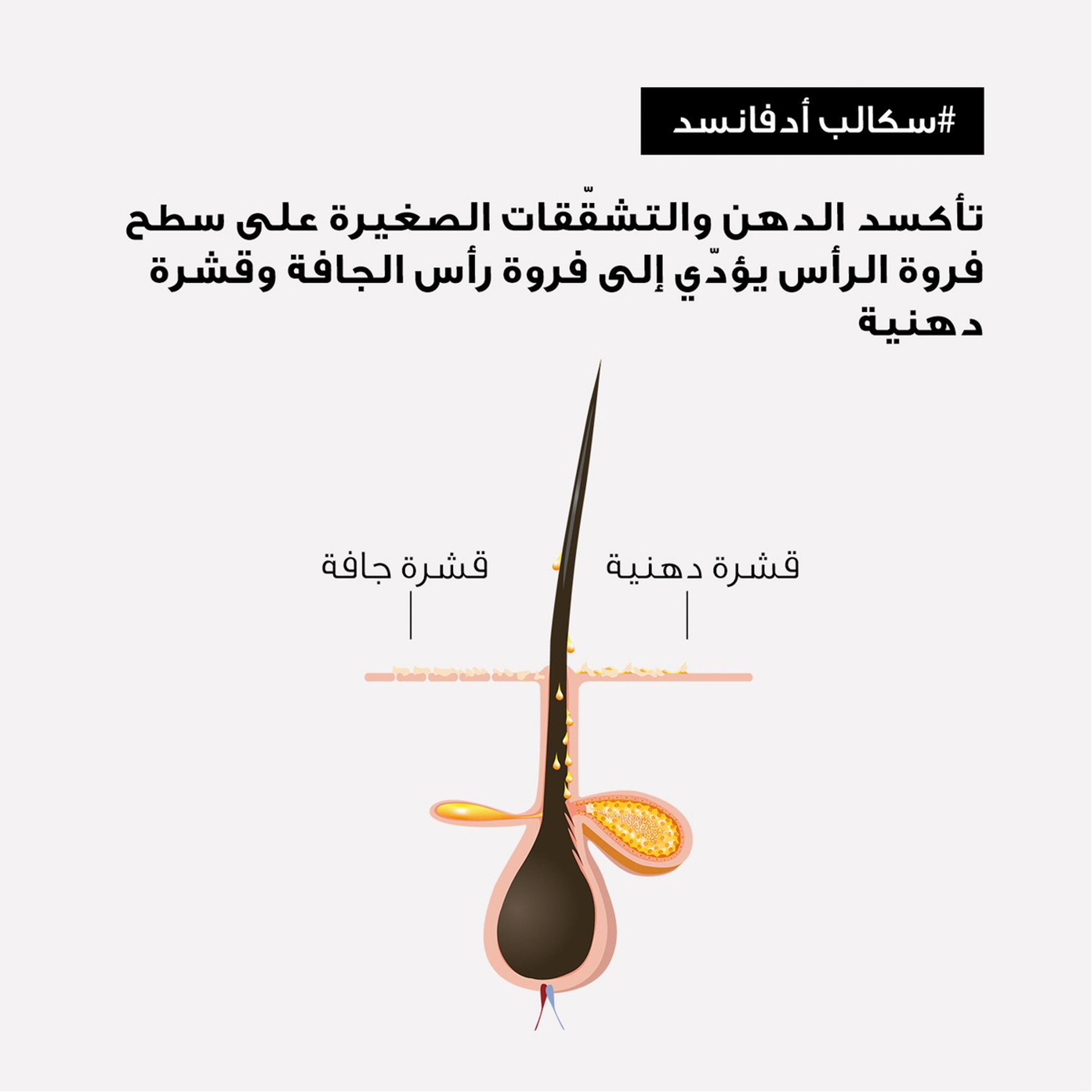 L’Oréal Professionnel Scalp Advanced Anti-Dandruff Dermo-Clarifier Shampoo For Dandruff Scalps |Serie Expert 300 Ml