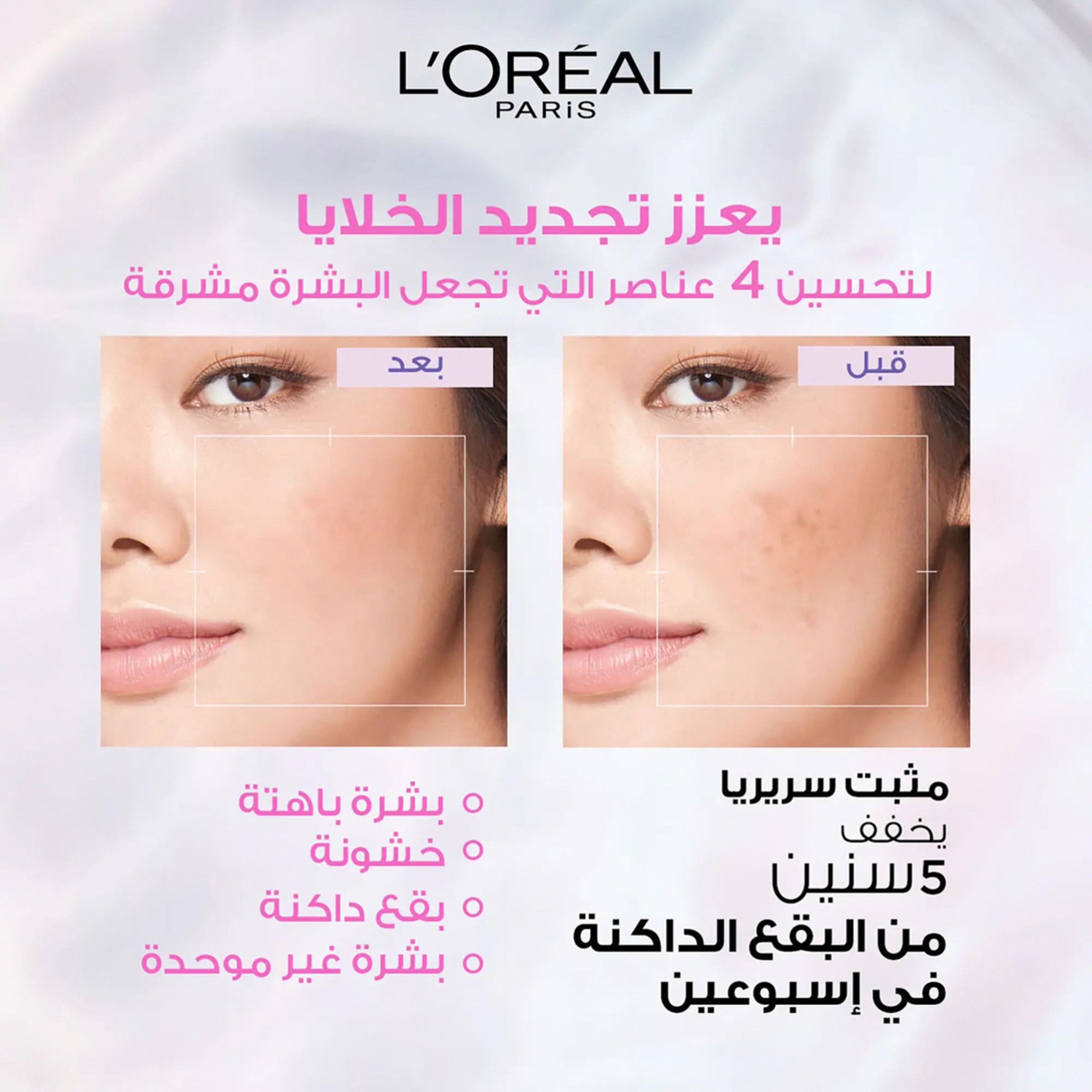 لوريال باريس سيروم للوجه جلايكوليك برايت ومكافحة البقع الداكنة، توهج فوري