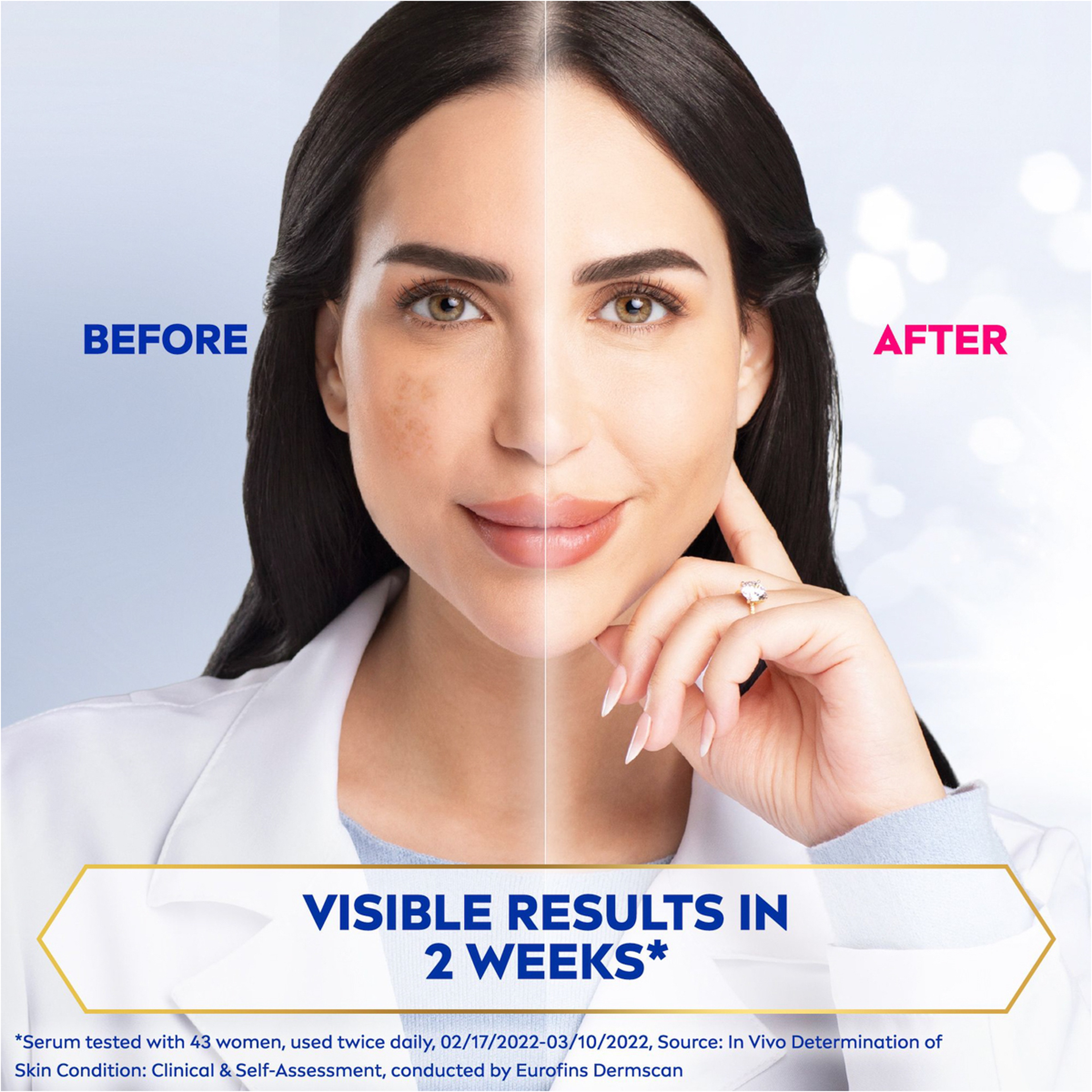 لومينوس سيروم ضد البقع علاج صغير 10مل