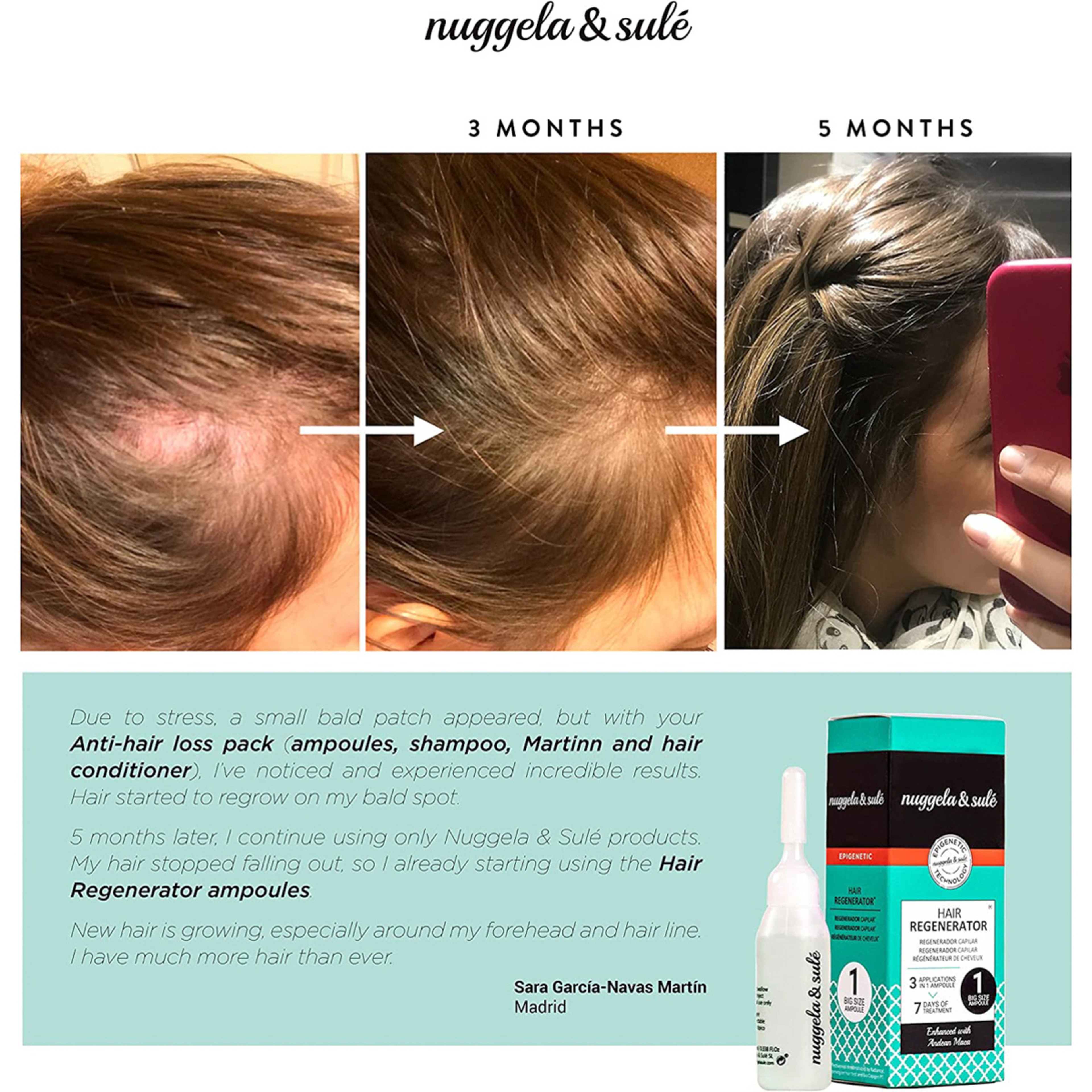 Nuggela & Sule Hair Regenerator 10 Amp