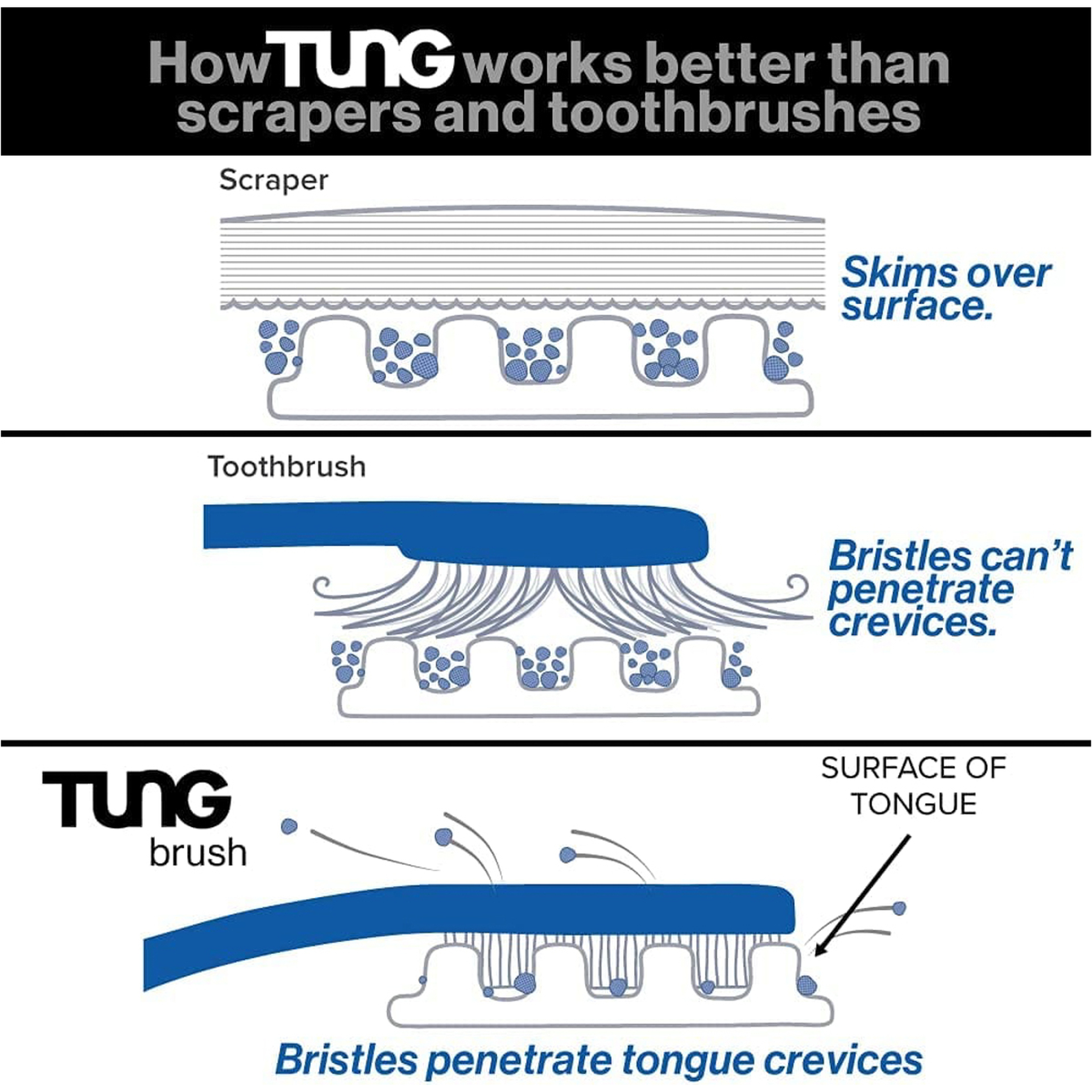 فرشاة تنظيف اللسان