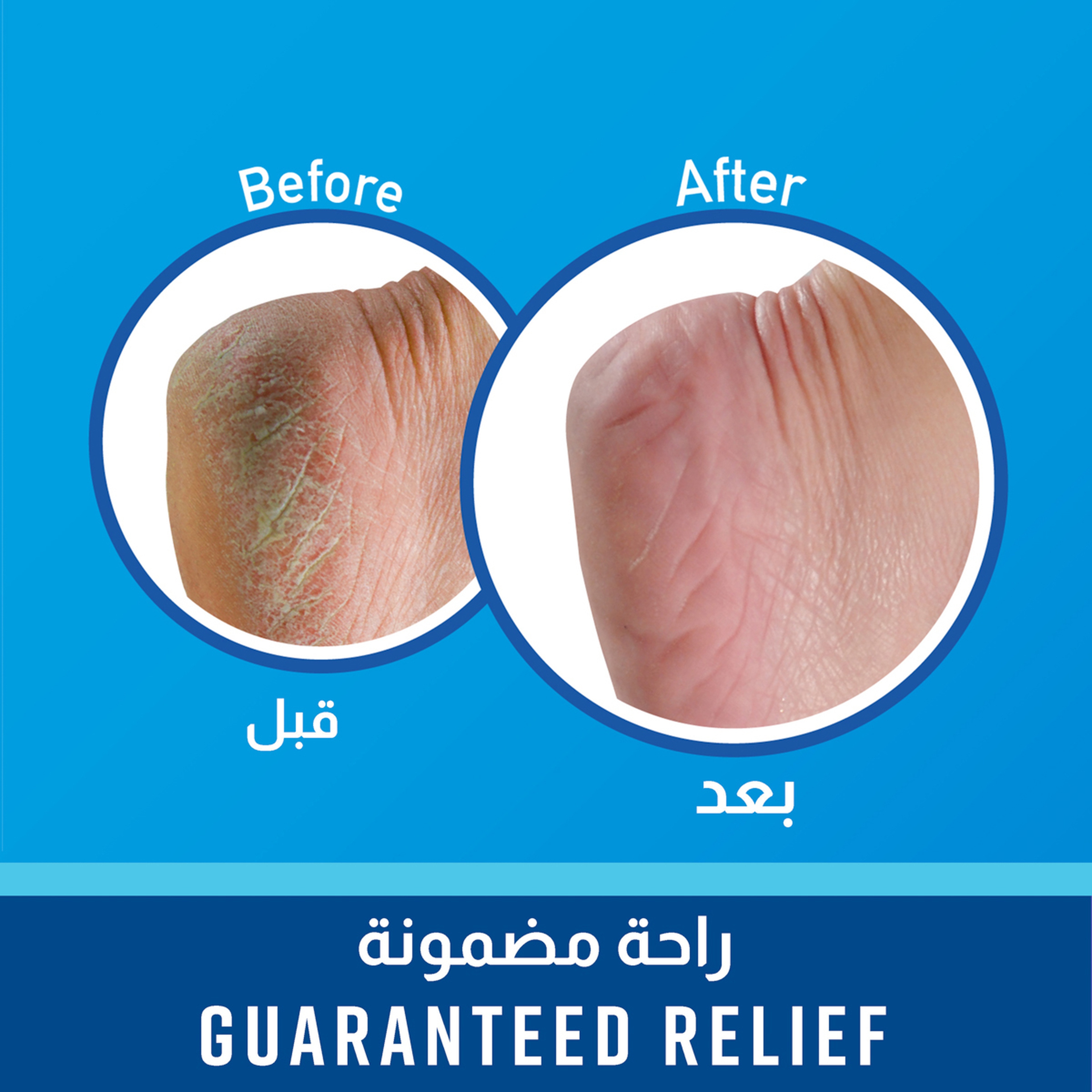 اوكيفيز كريم للترطيب العميق للقدمين 85g