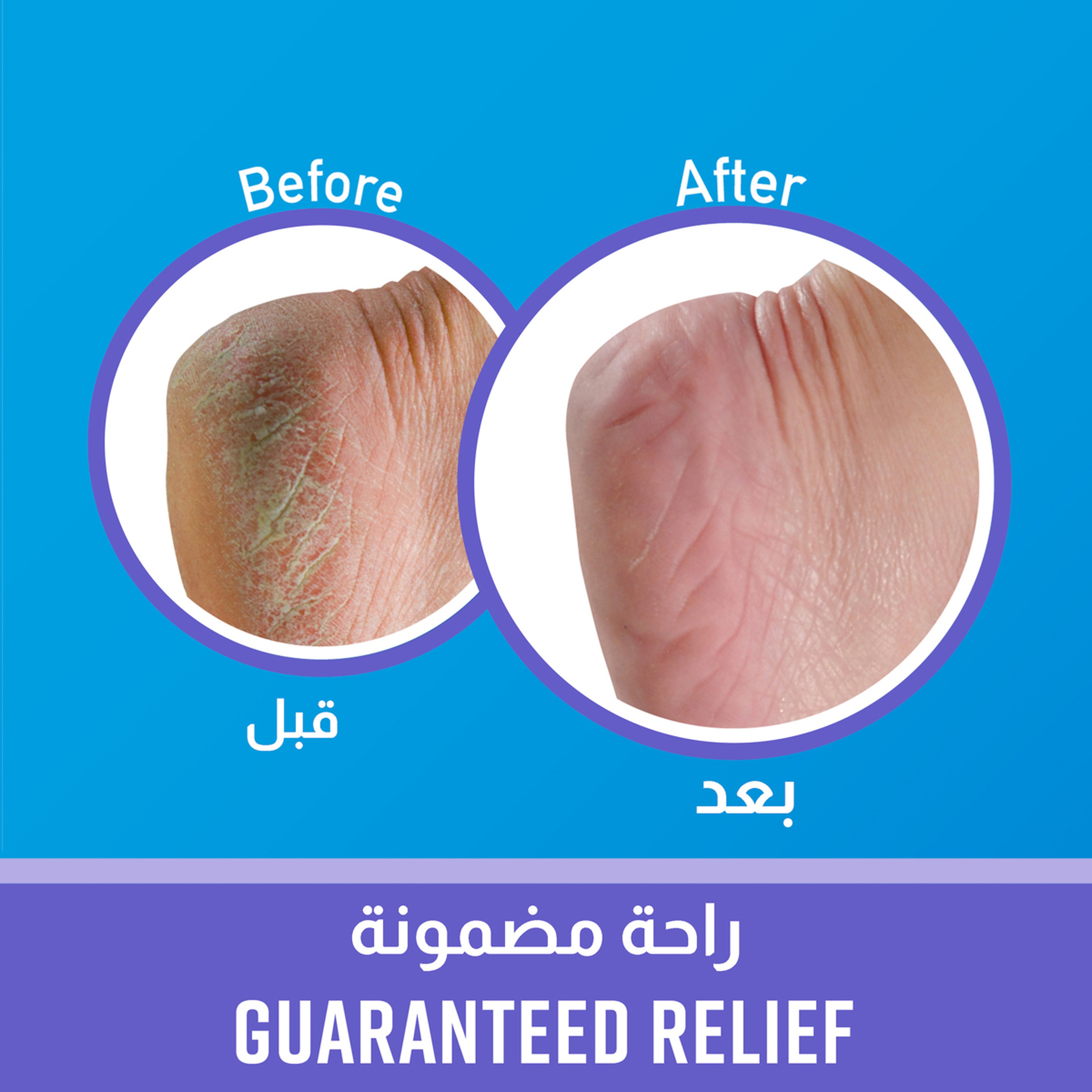 اوكيفيز كريم للترطيب العميق للقدمين "راحة ليلية" 85g