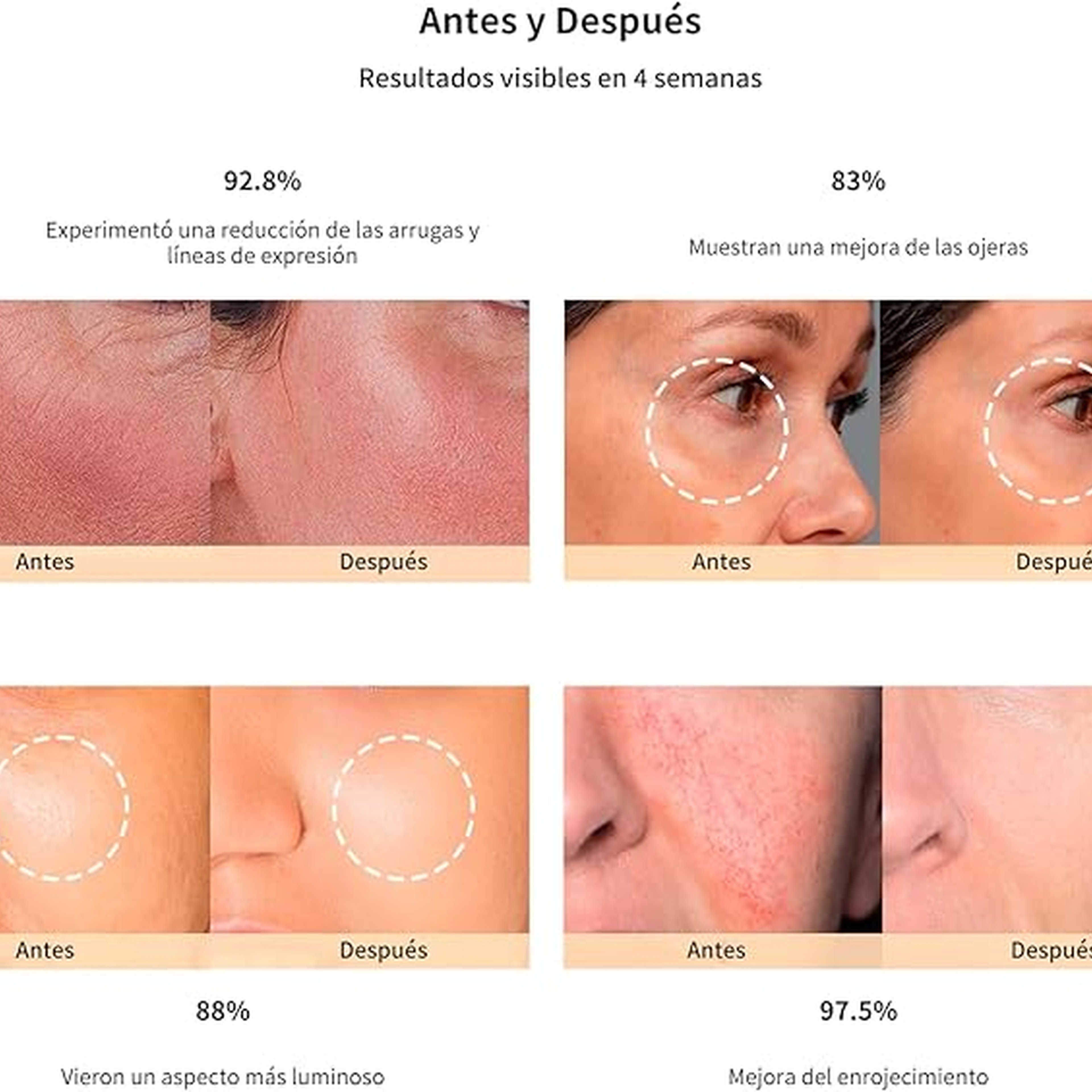 Jovs 4D Laser Light Therapy Mask