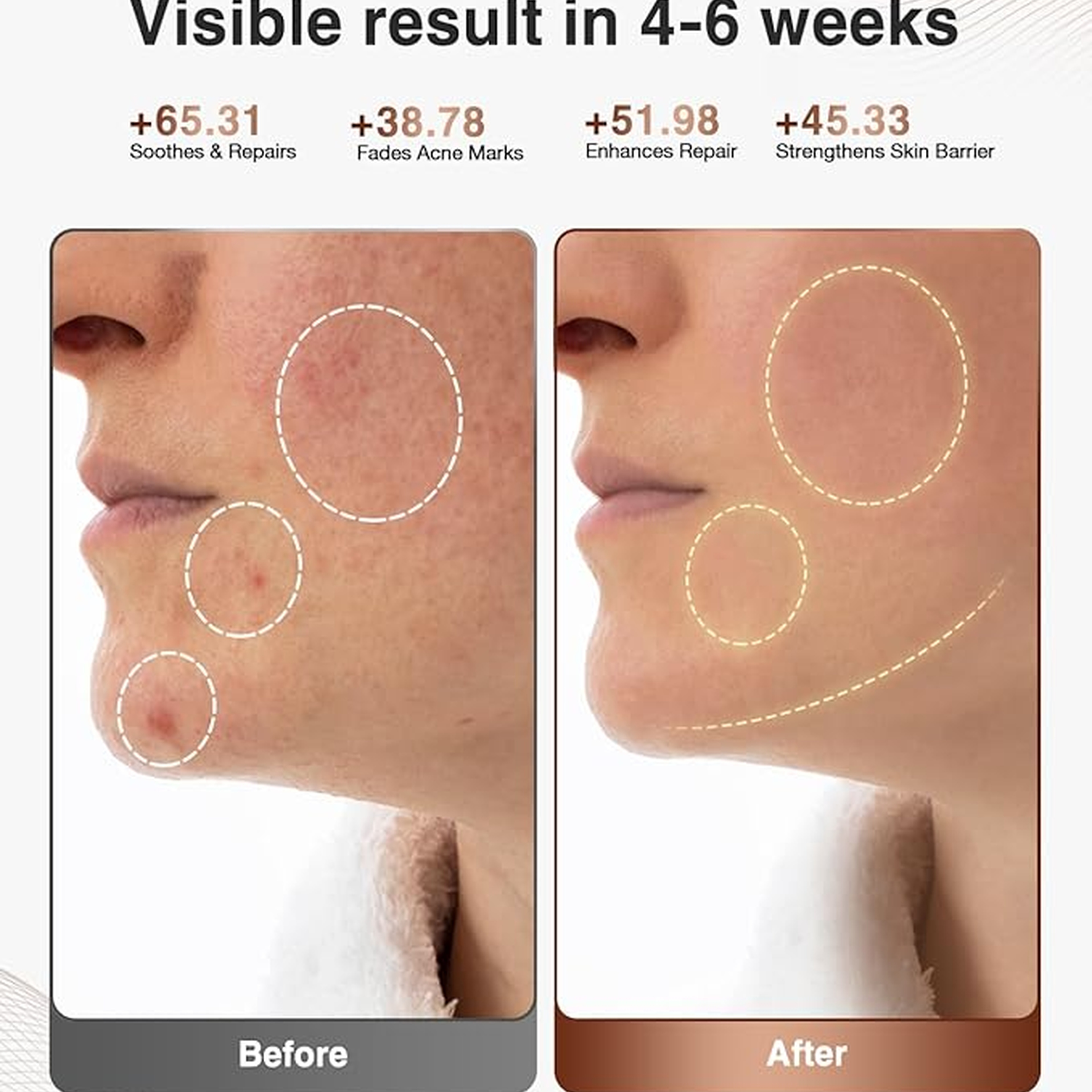 Jovs 4D Laser Light Therapy Mask