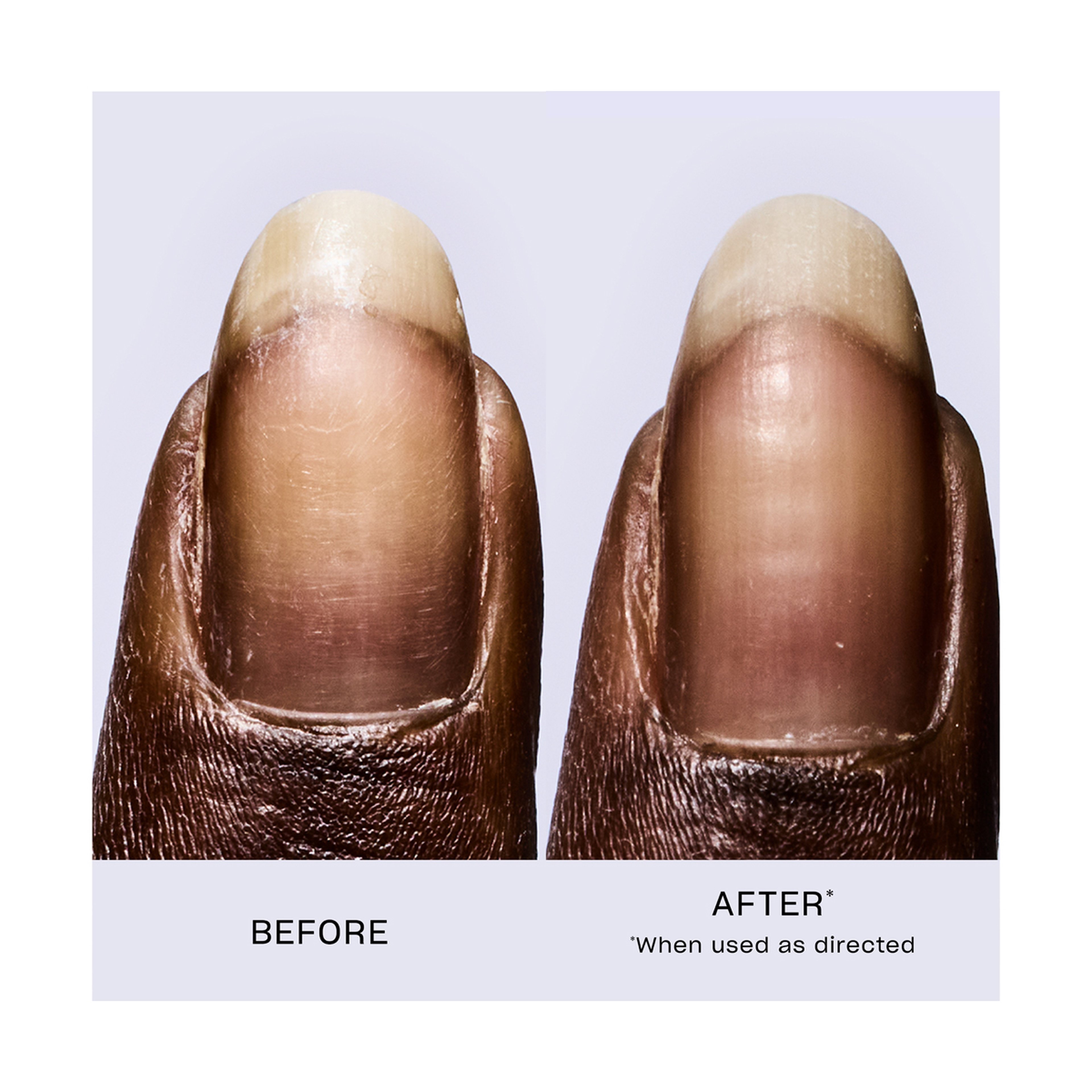 إصلاح كيراتين الأظافر بنسبة 99%* خلال 6 أيام