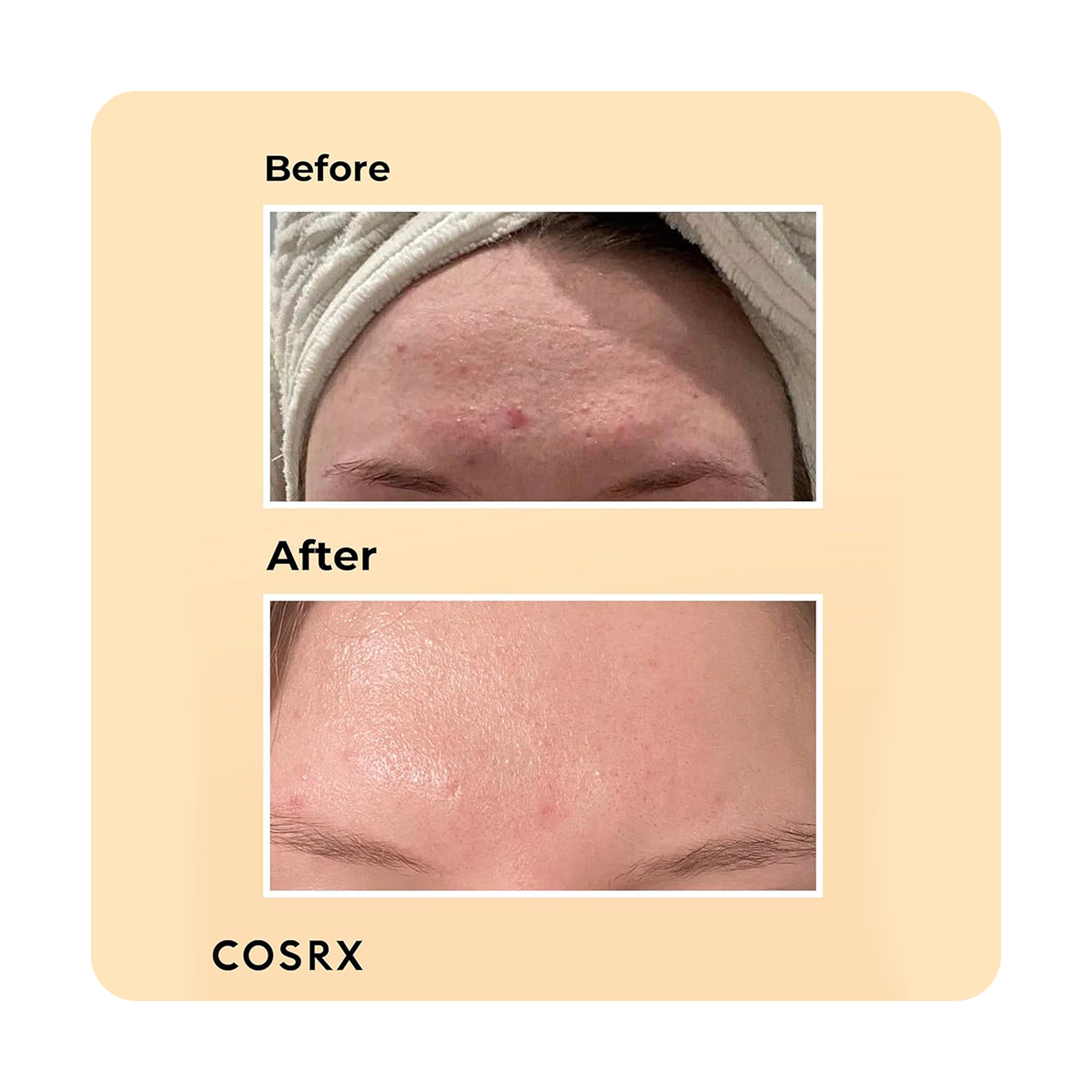 Cosrx Advanced Snail 96 Mucin Power Essence - 100ml