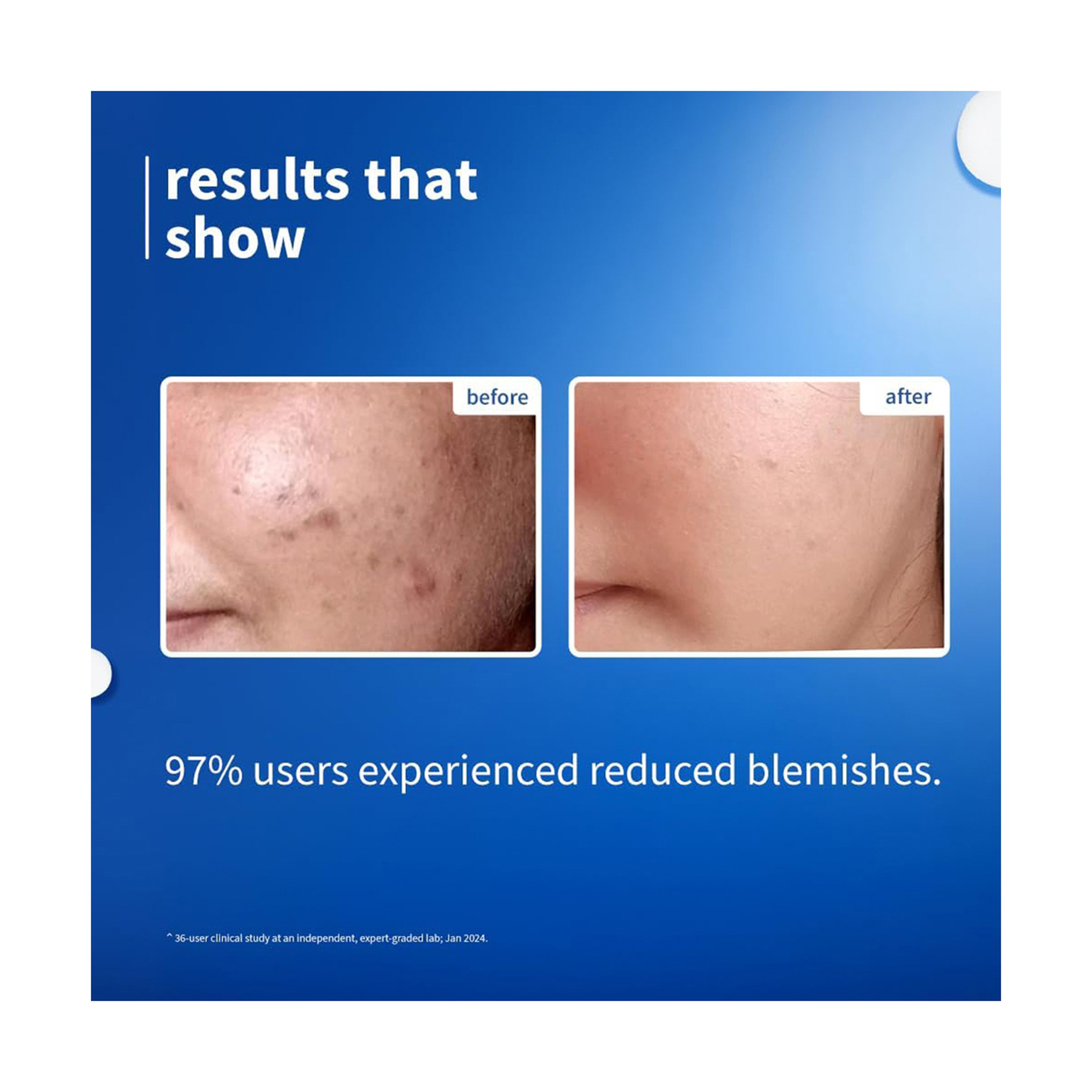 بلوم سيروم 10% نياسيناميد وماء أرز 30 مل