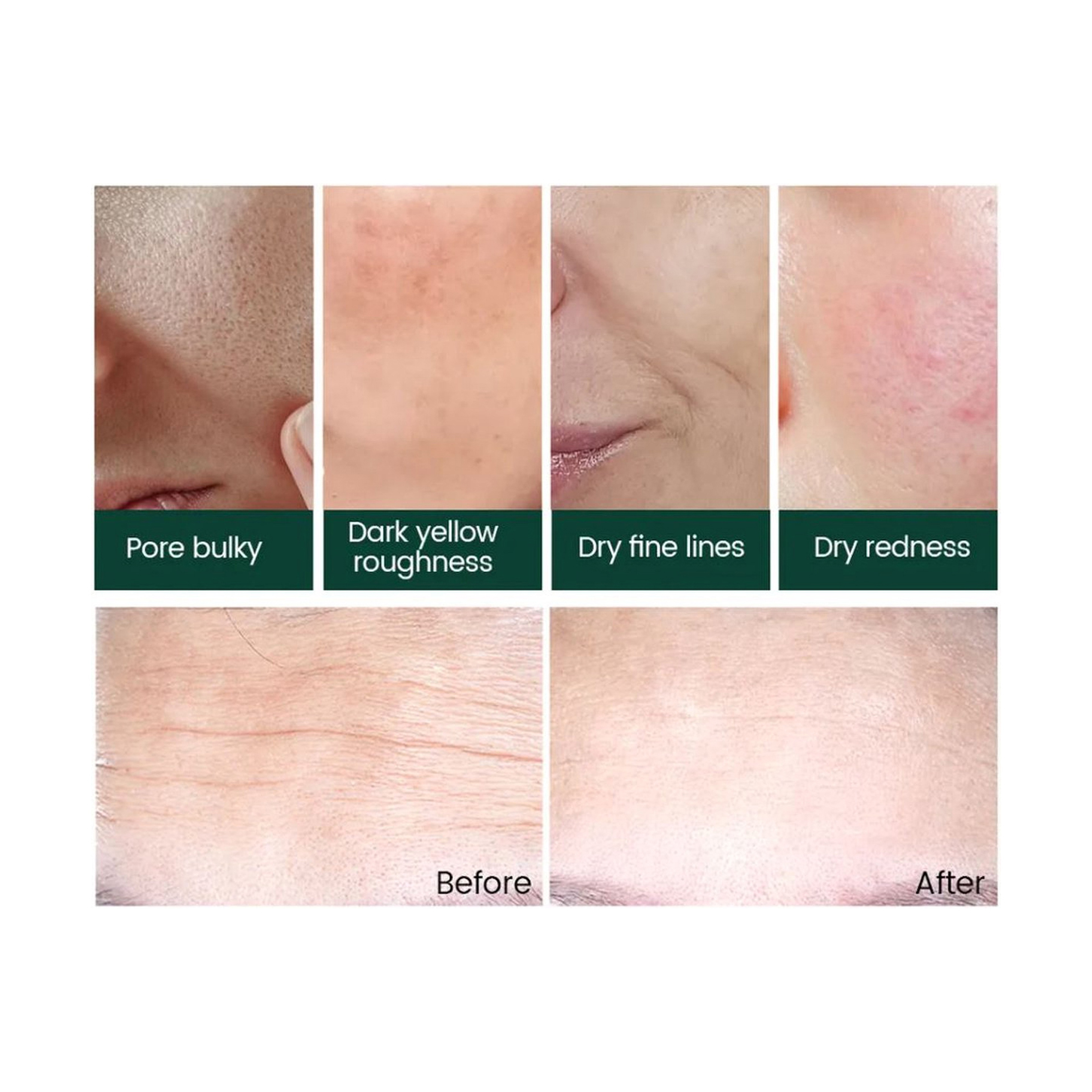 Vibrant Glamour Retinol Mask Set for Restoring Skin Radiance 5 Pieces (1 Piece / 25 ml)