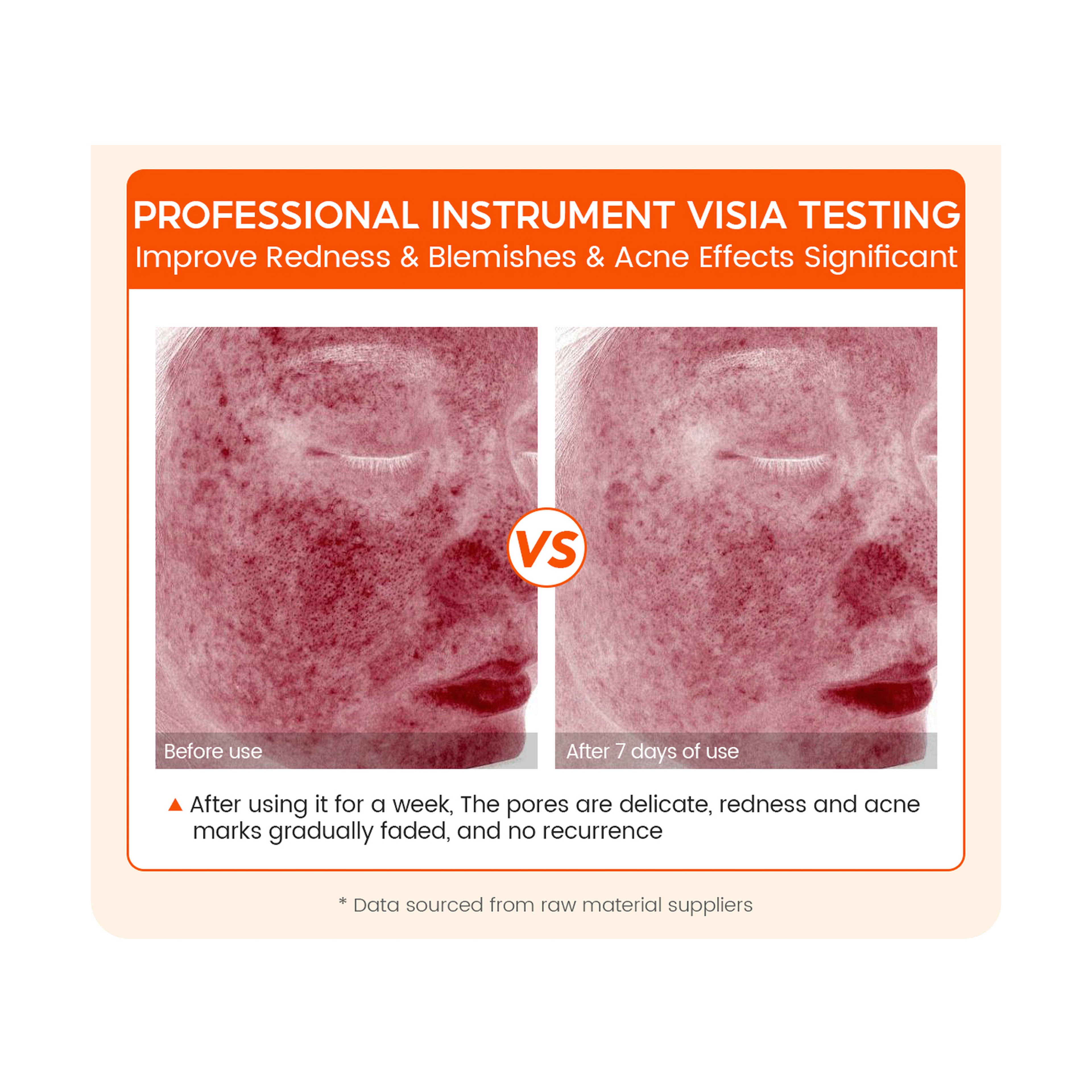 Vibrant Glamour 2% Salicylic Acid Exfoliating Serum Anti-Acne 30 ml