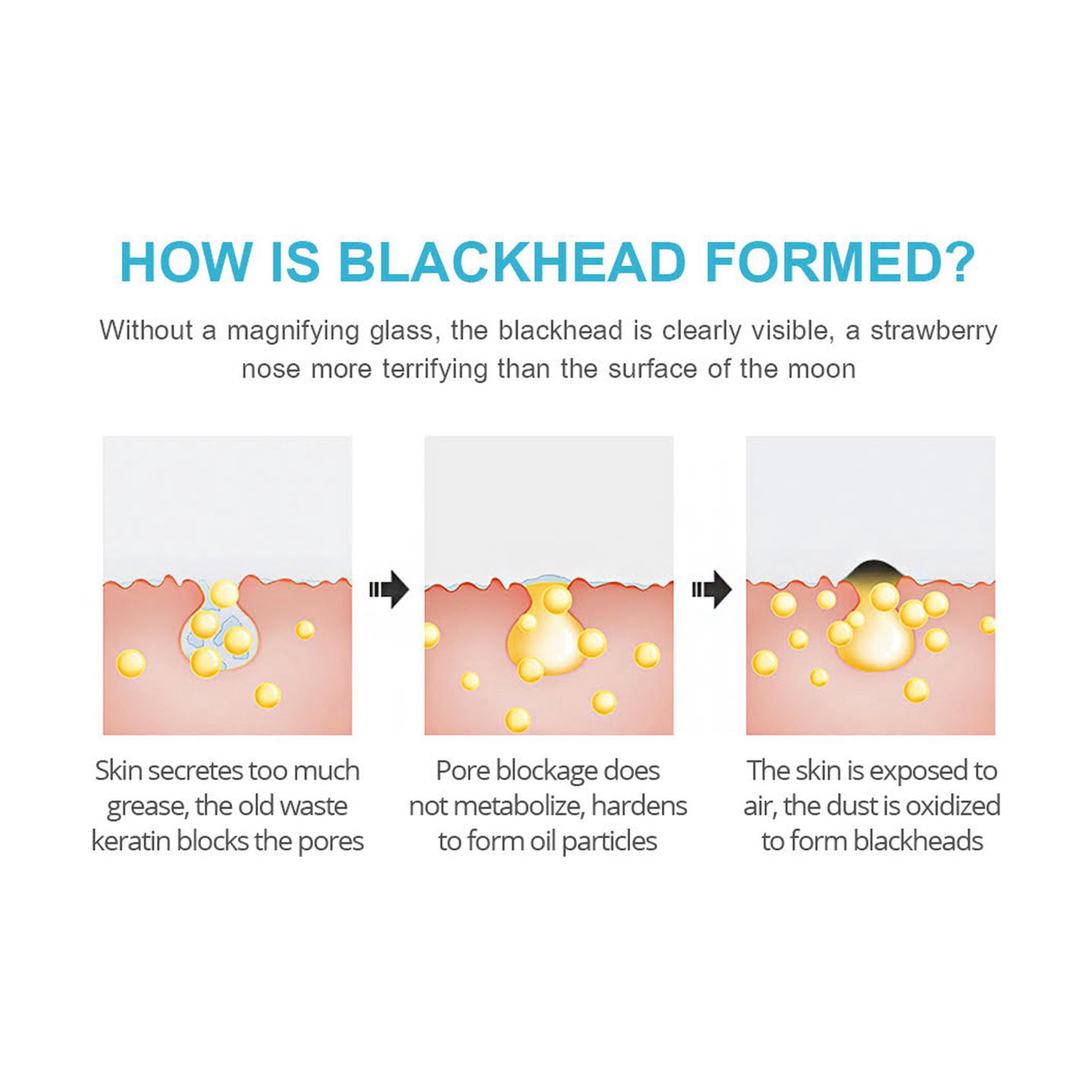 Vibrant Glamour Charcoal Mask for Blackhead Removal 30 g