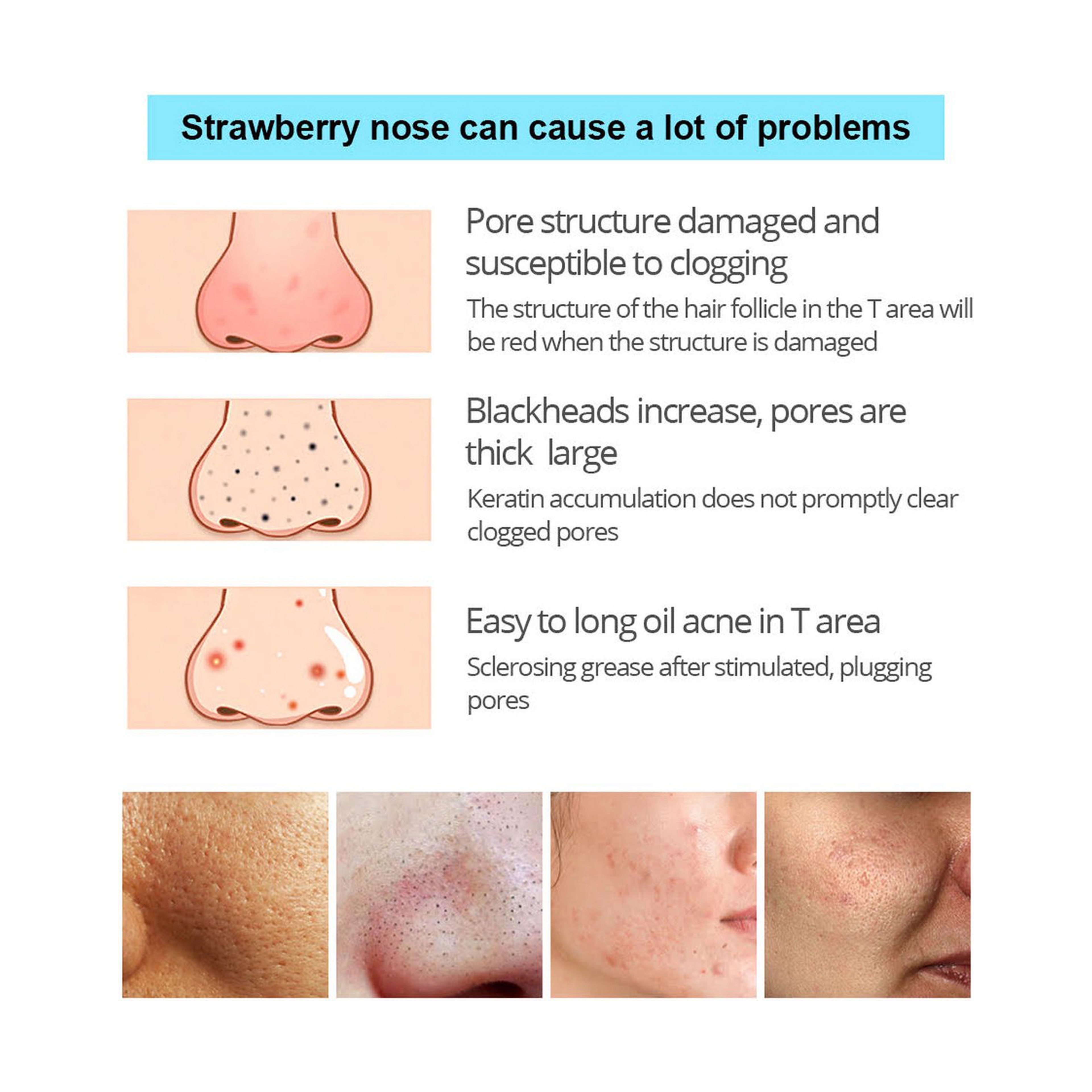 Vibrant Glamour Charcoal Mask for Blackhead Removal 30 g