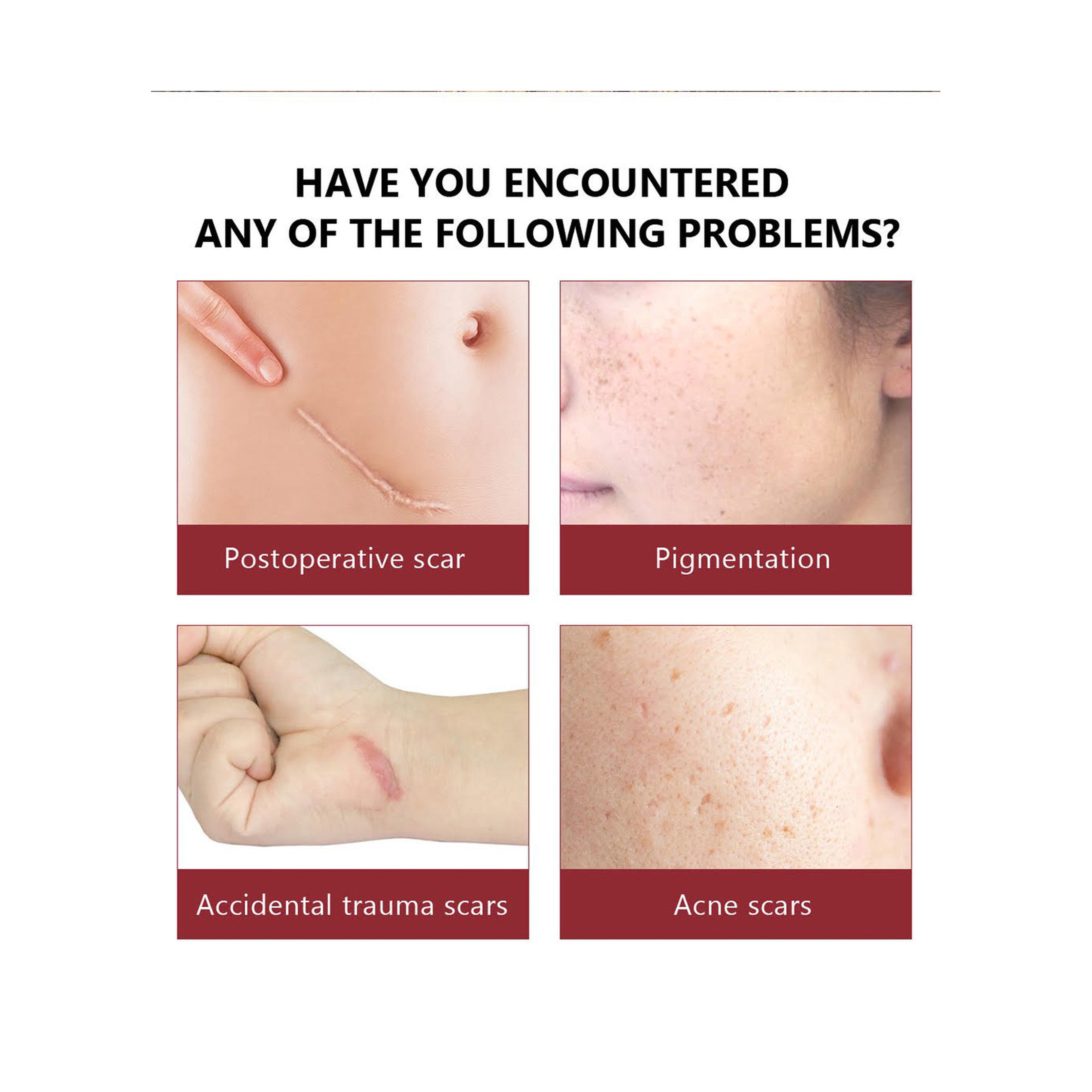 Vibrant Glamour Crocodile Serum for Scar, Stretch Mark, and Acne Treatment 30 ml