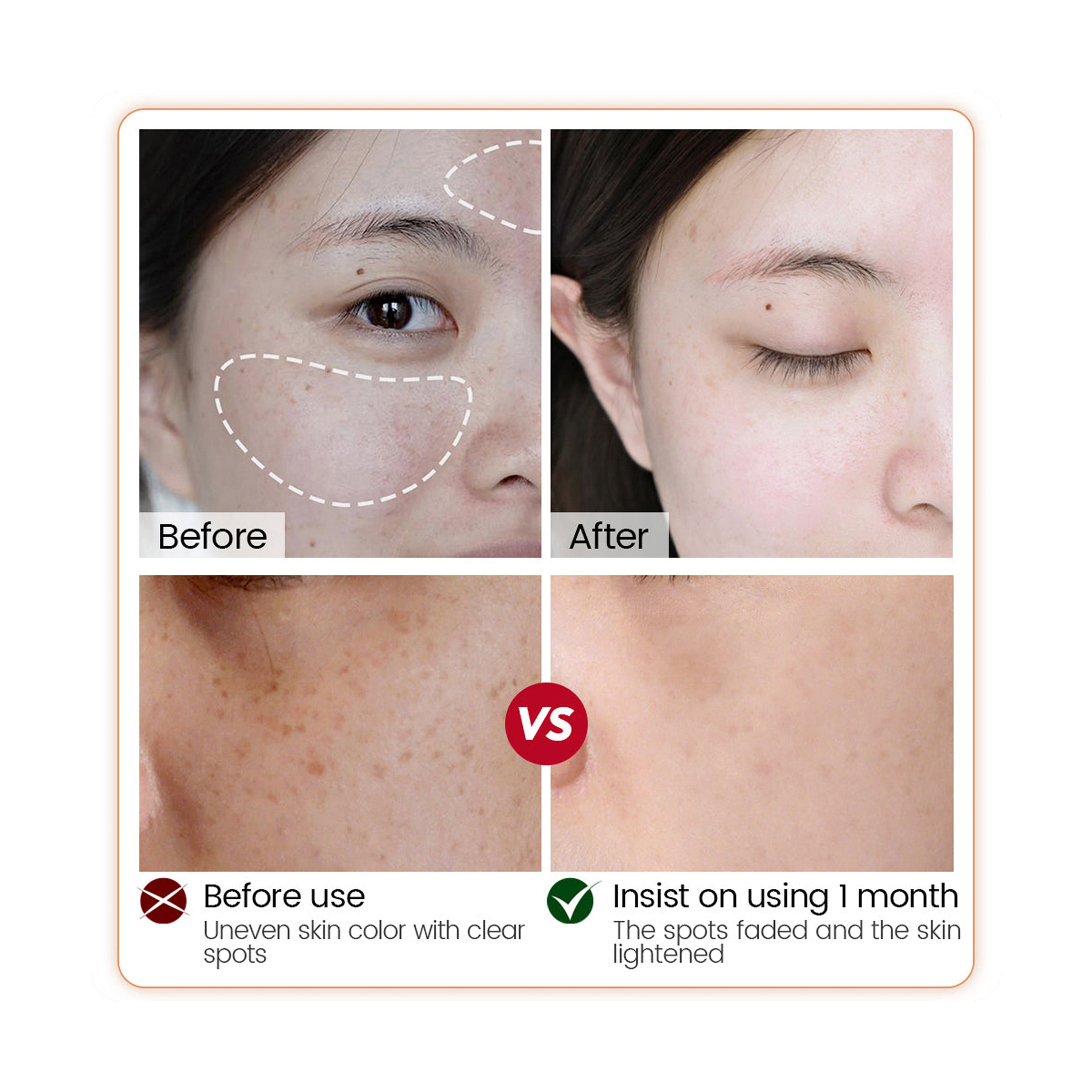 Vibrant Glamour Arbutin Serum with Niacinamide and Vitamin C for Skin Brightening and Dark Spot Reduction 30 ml