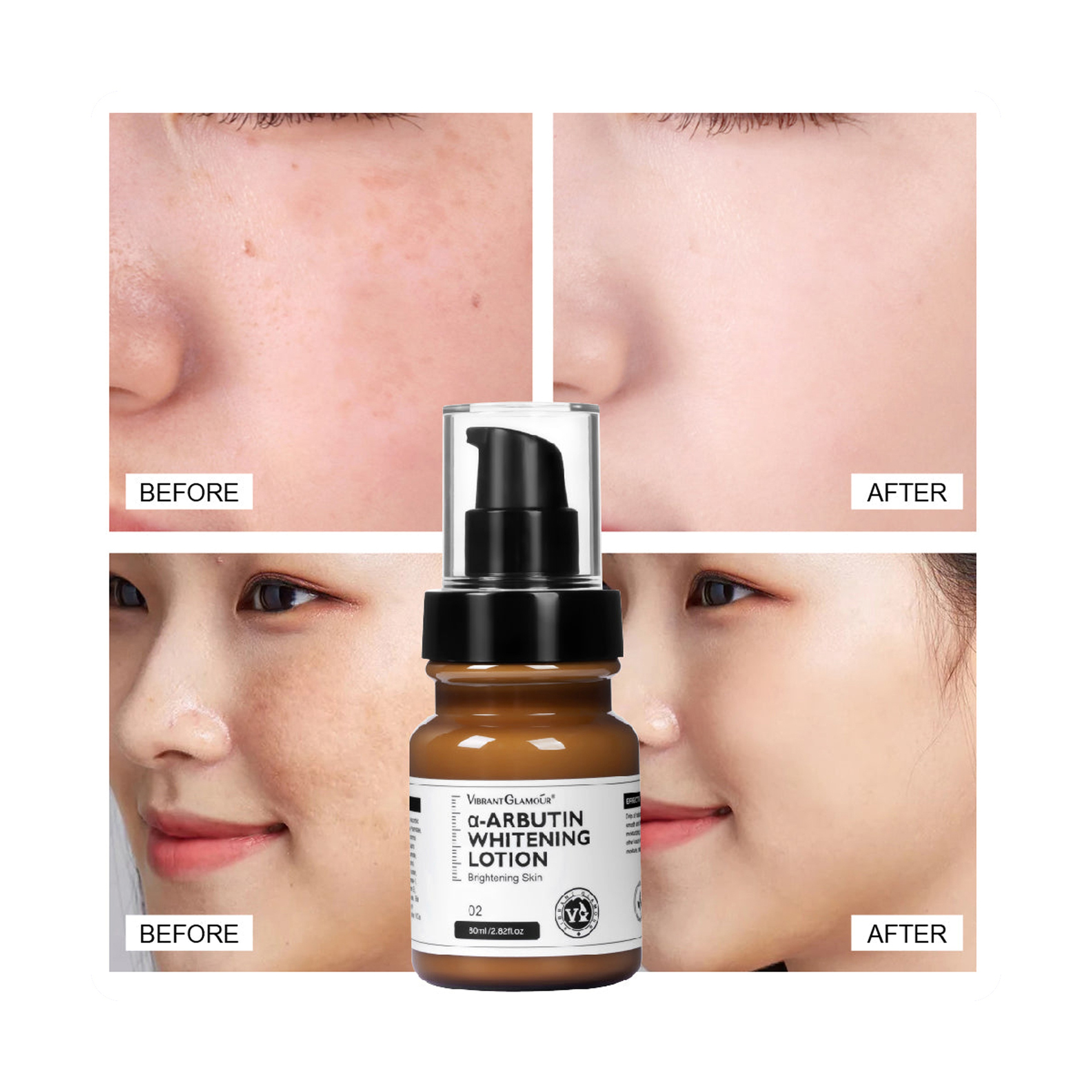 Vibrant Glamour Arbutin Lotion for Skin Brightening, Freckle Reduction, and Dark Spot Removal 80 ml