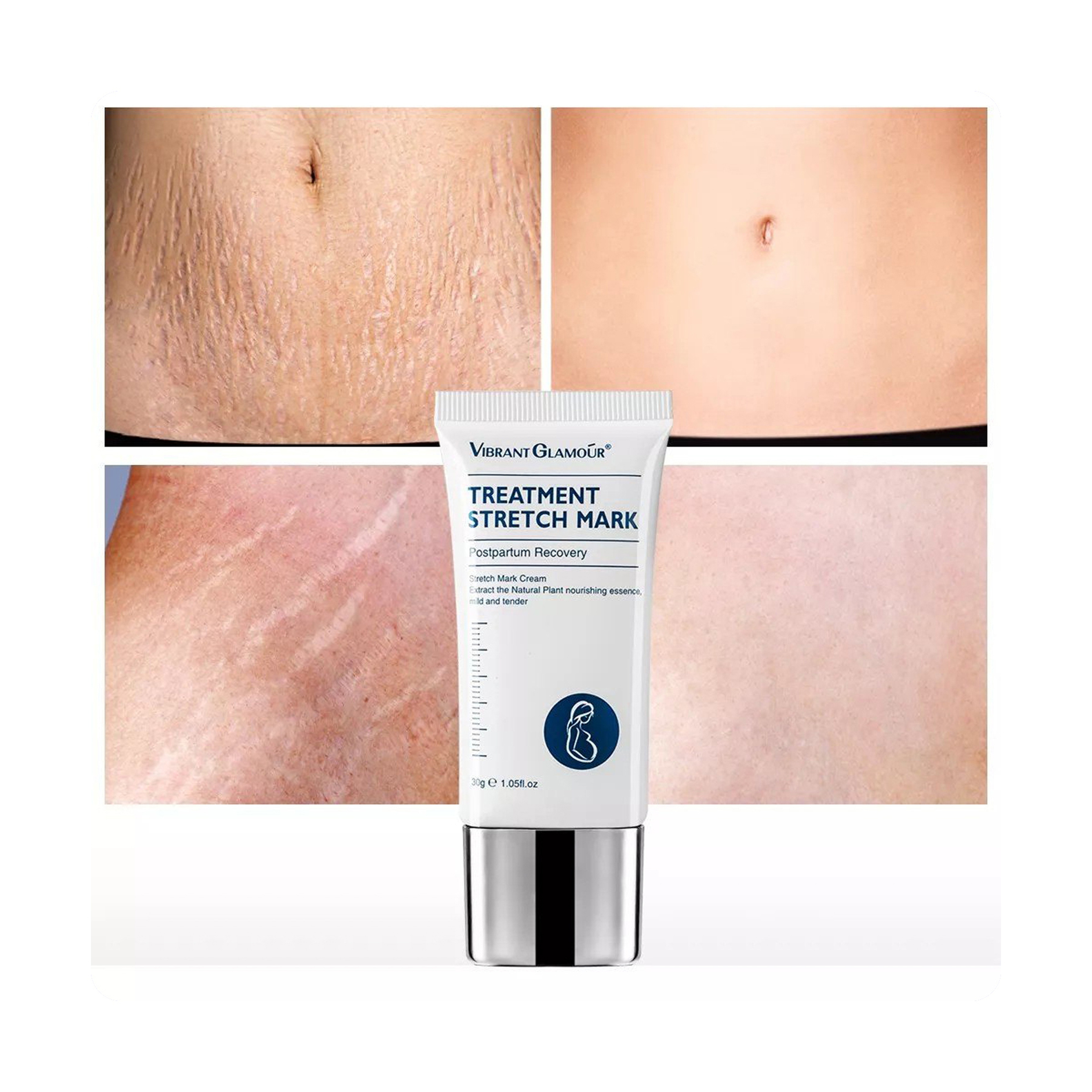 كريم فايبرنت جلامور لعلاج علامات التمدد  ومضاد للشيخوخة 30 جرام