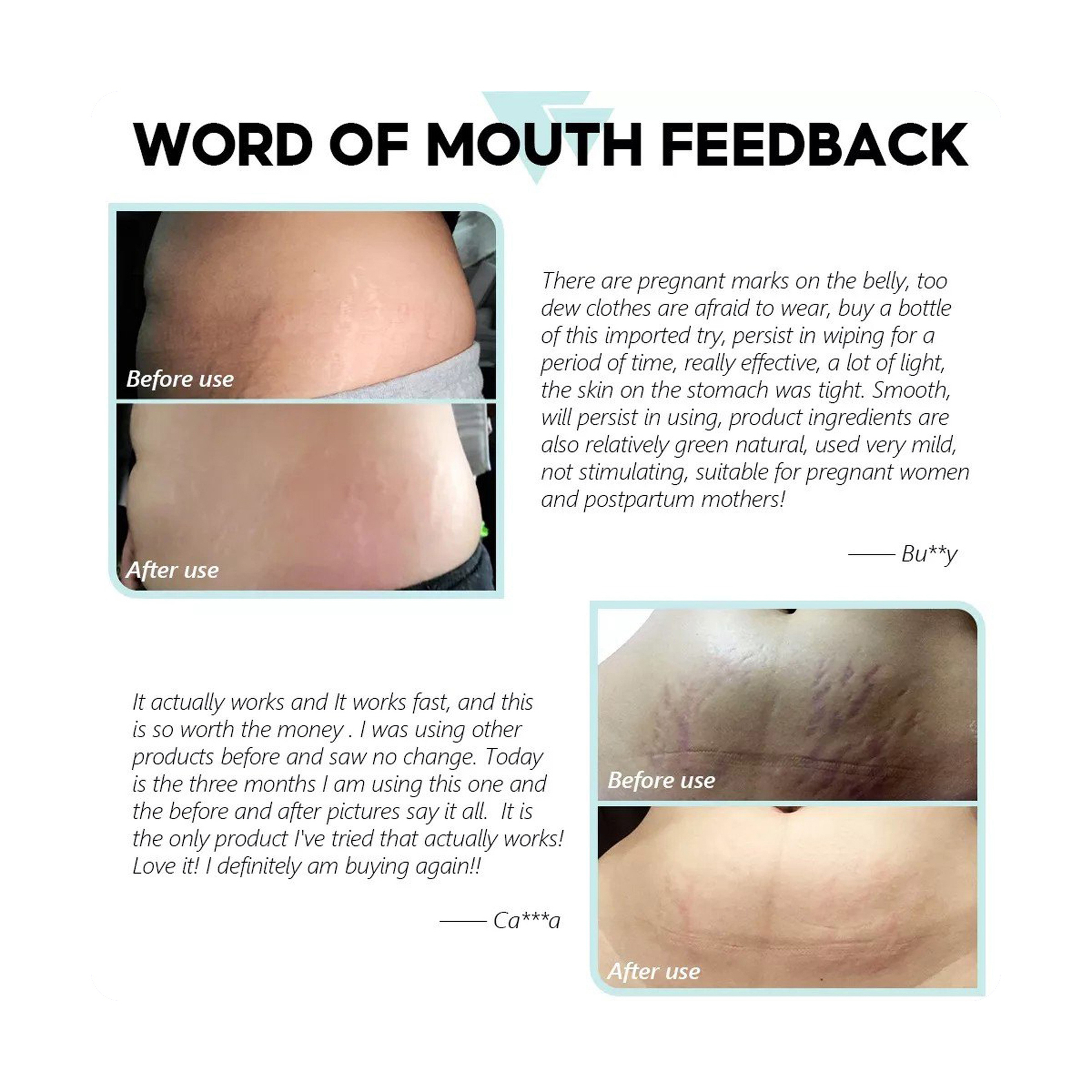 كريم فايبرنت جلامور لعلاج علامات التمدد  ومضاد للشيخوخة 30 جرام