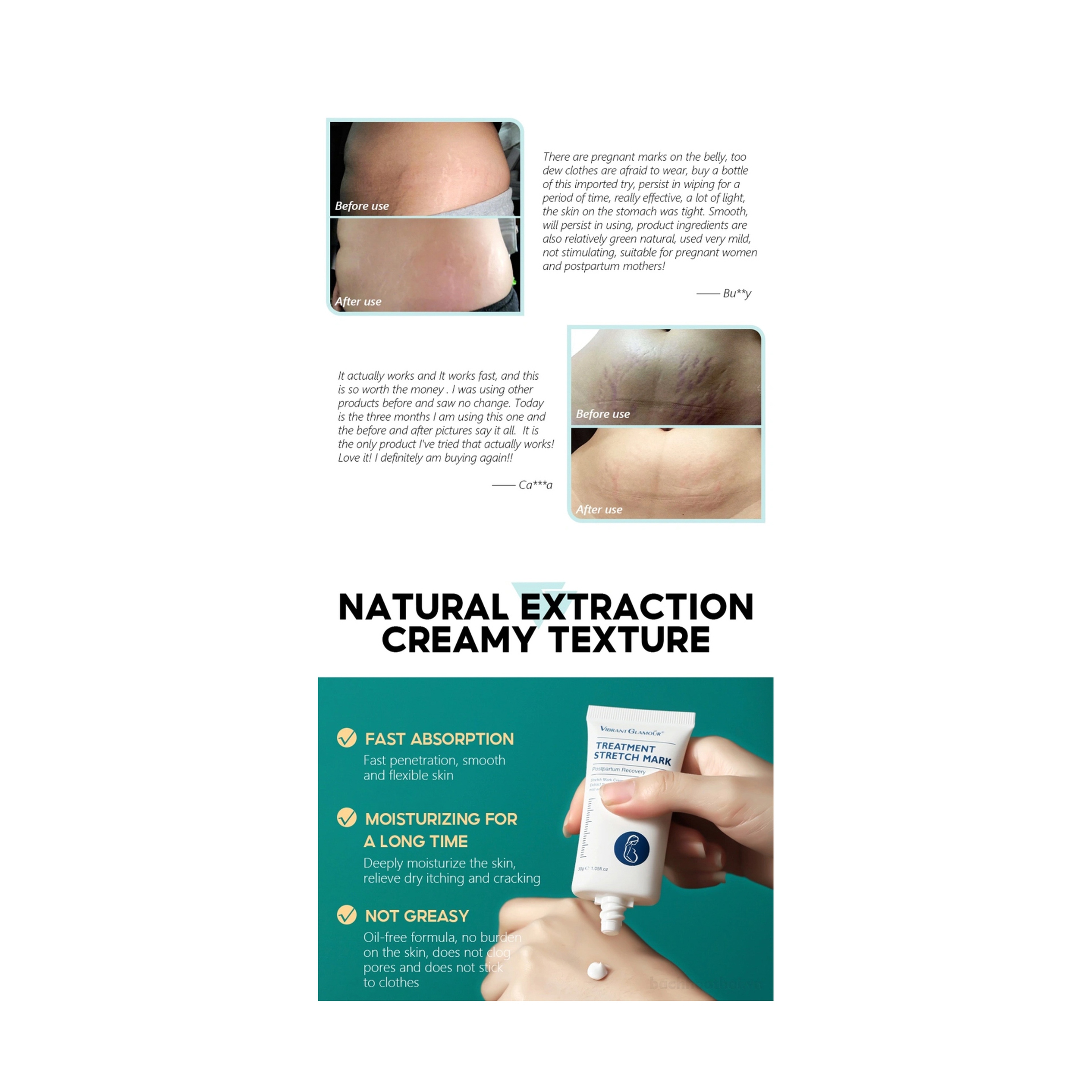 كريم فايبرنت جلامور لعلاج علامات التمدد  ومضاد للشيخوخة 30 جرام