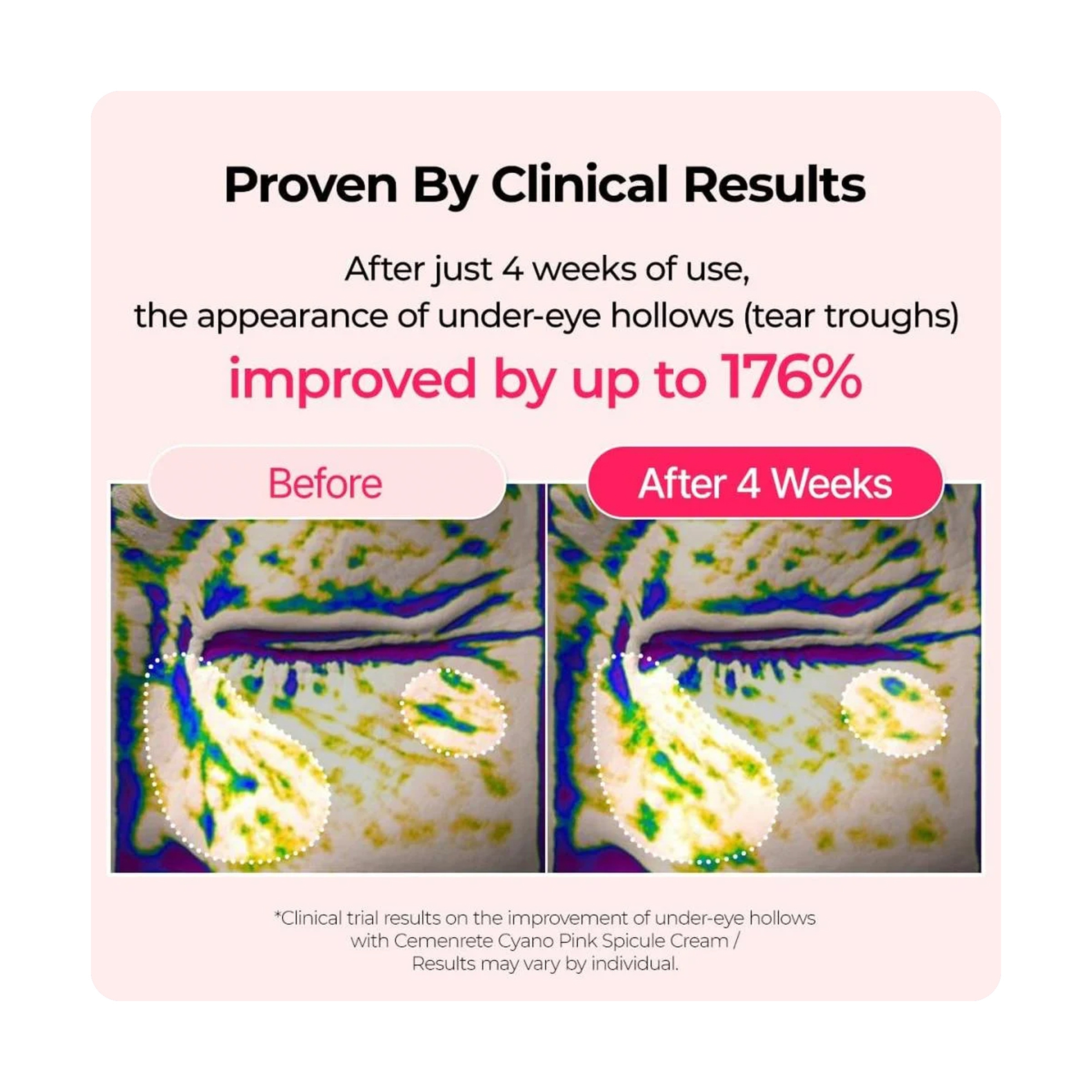 Dr.Melaxin Calcium B12 Spicule Cream 50g