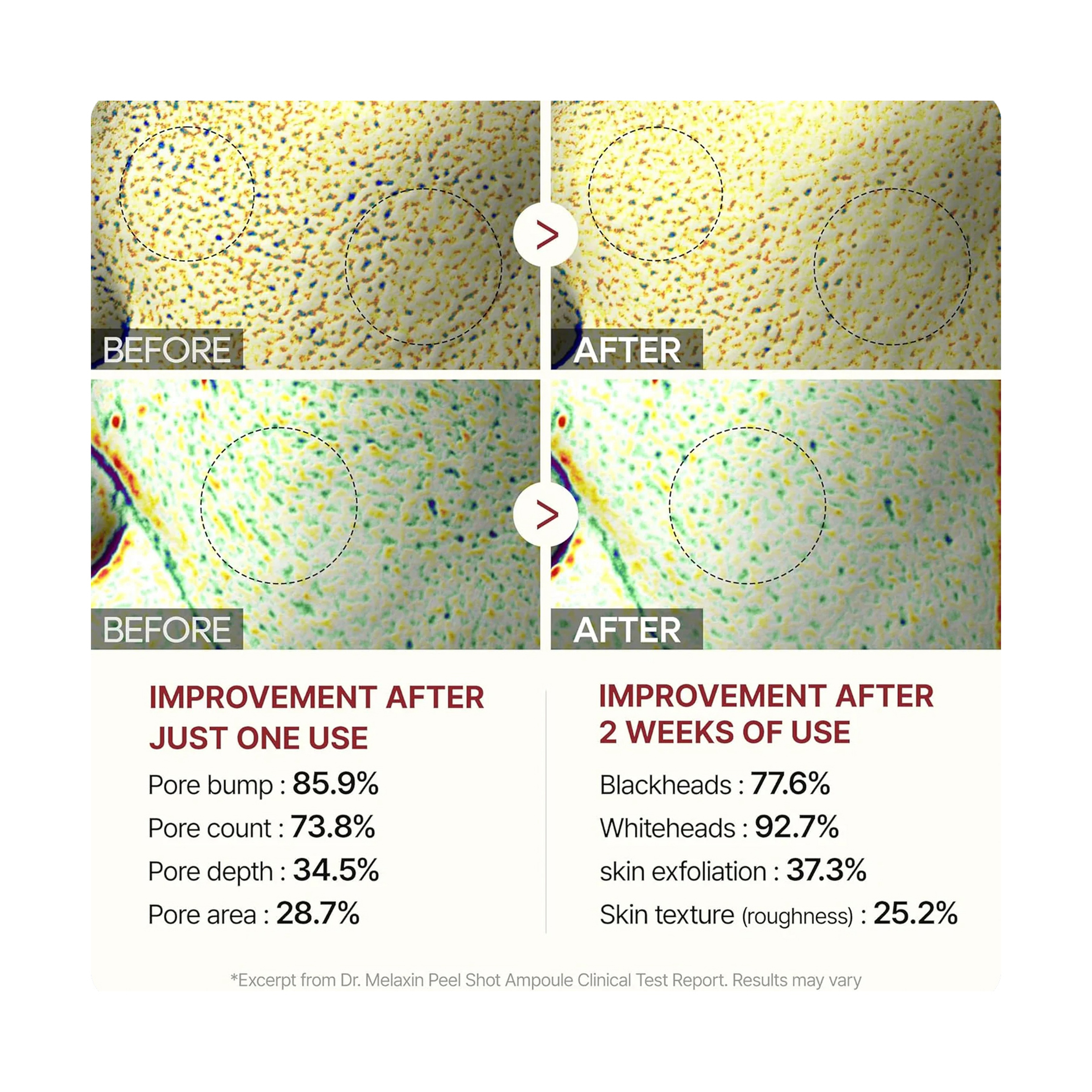 Dr.Melaxin Black Rice Peeling Ampoule