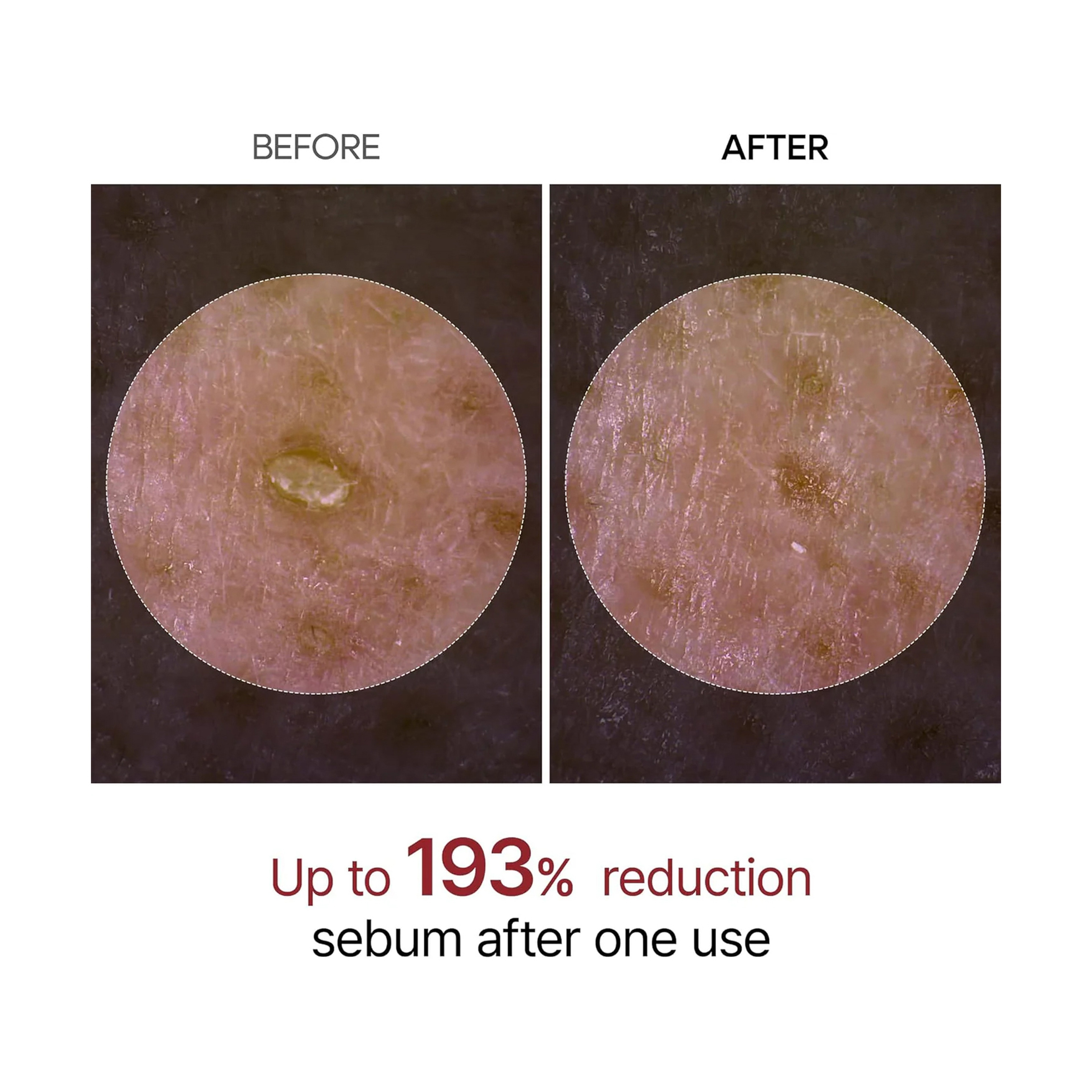 Dr.Melaxin Black Rice Peeling Ampoule