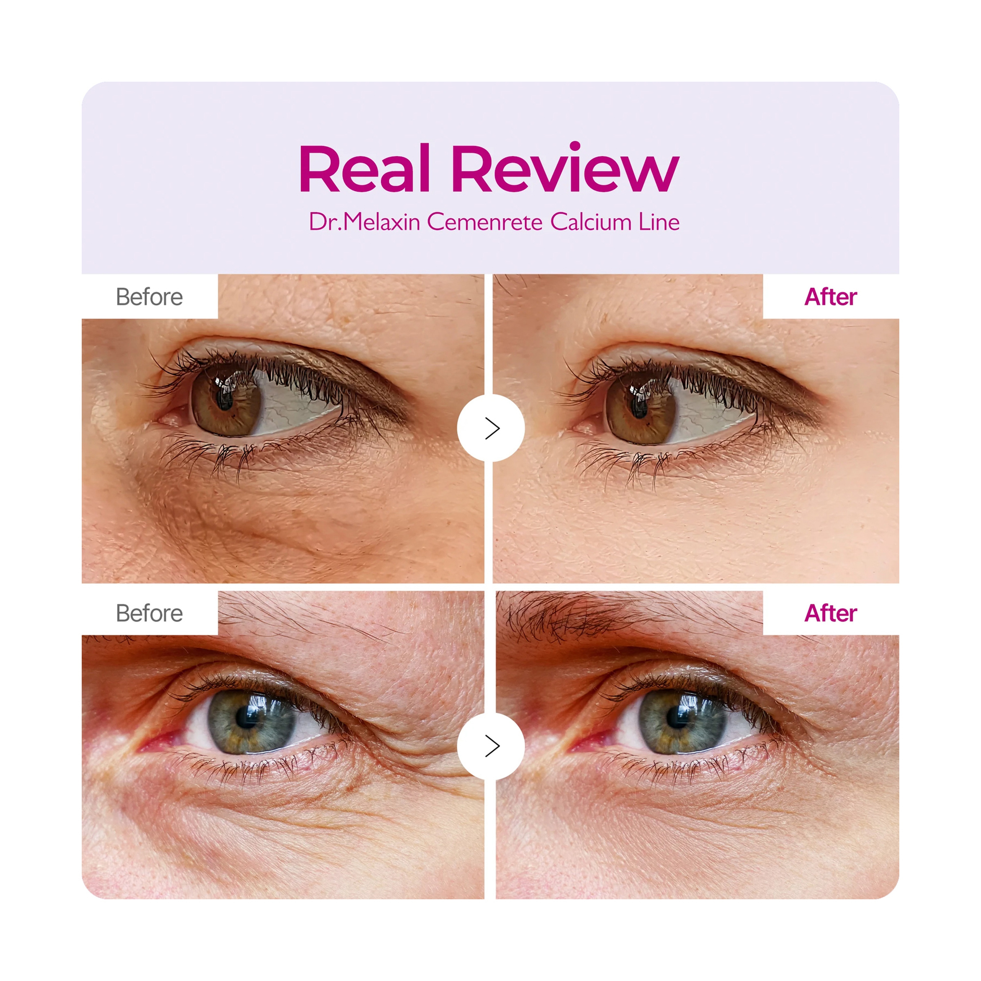 Dr.Melaxin Calcium Multi Balm 9g