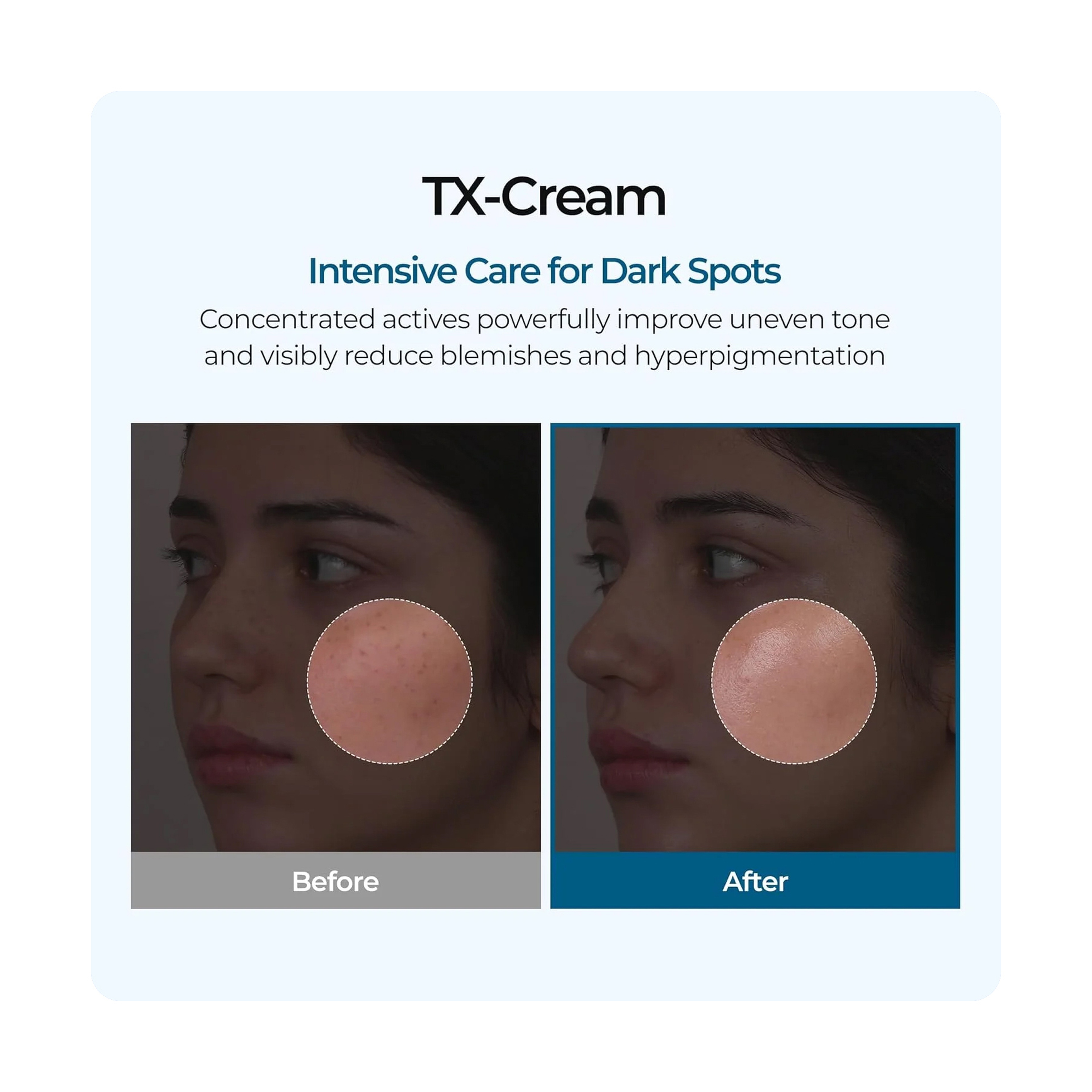 Dr.Melaxin Texas Cream 50g