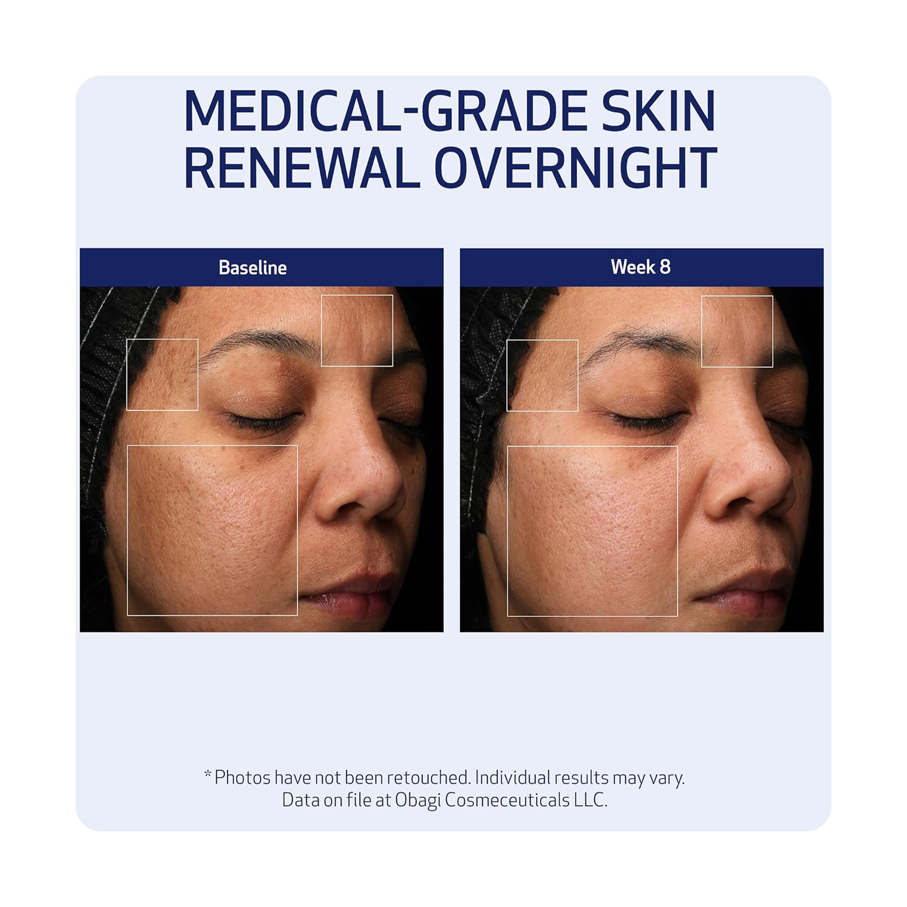 أوباجي كريم ريتينول +PHA ليلي