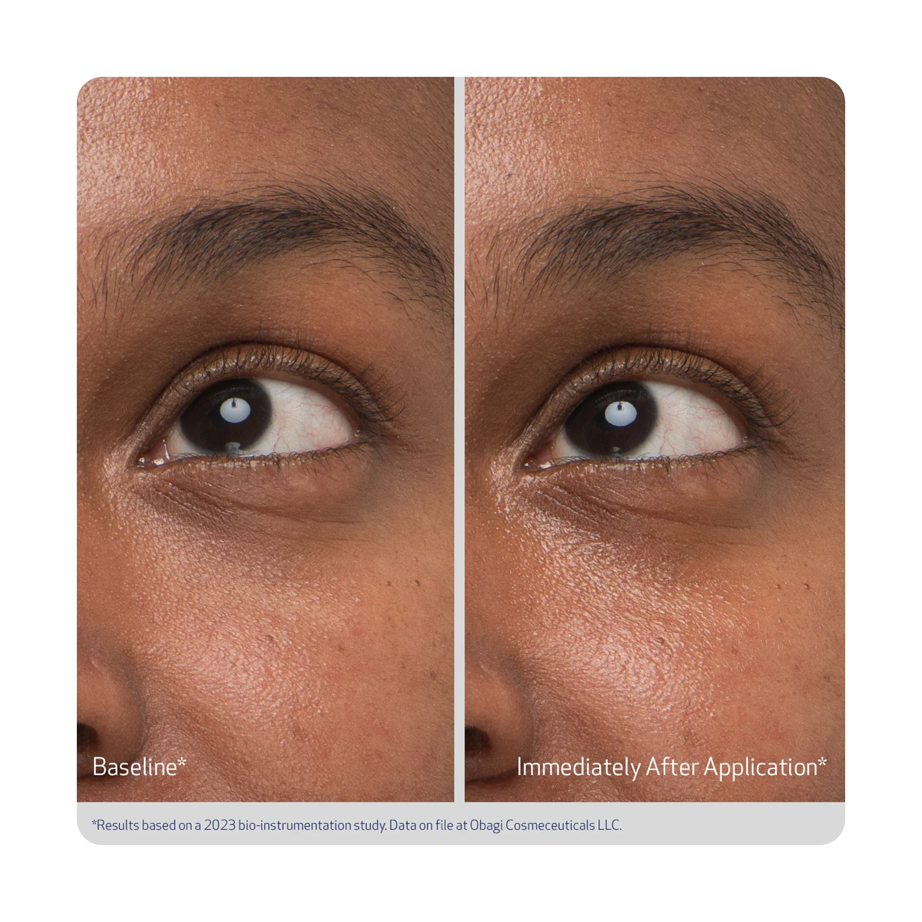 أوباجي هايدرو دروبس كريم عين