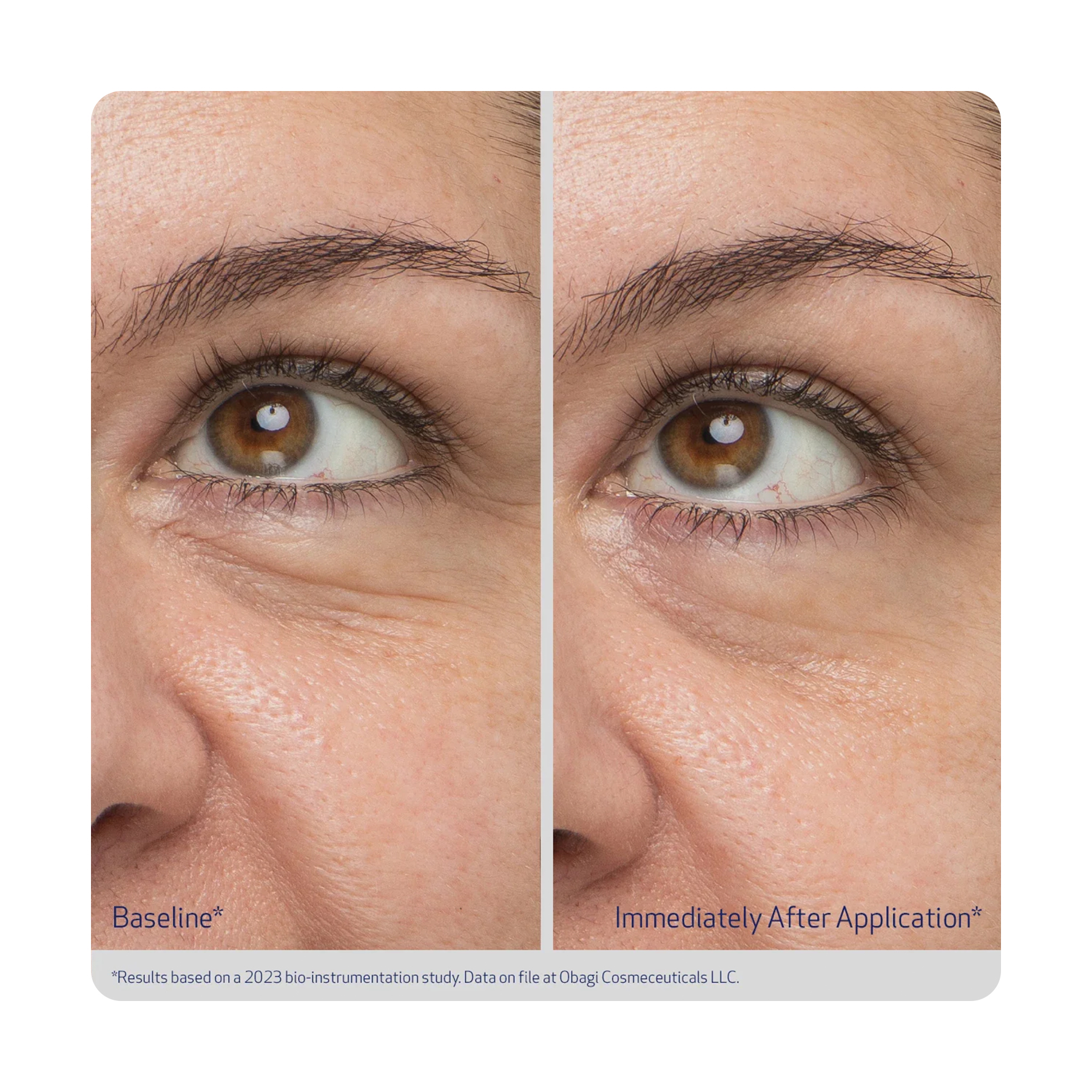 أوباجي هايدرو دروبس كريم عين