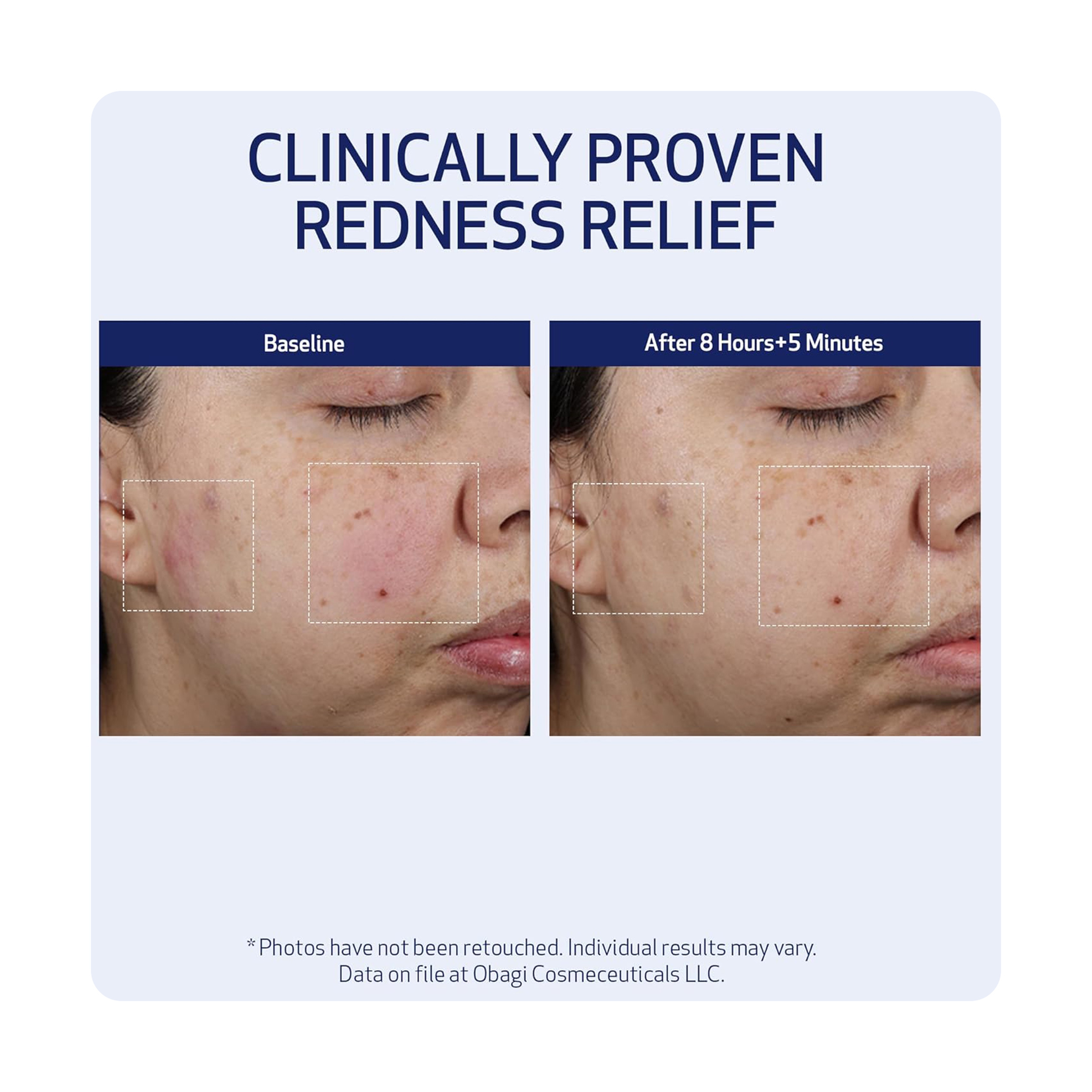 Obagi Suzan Md Moisture Restore 50Ml