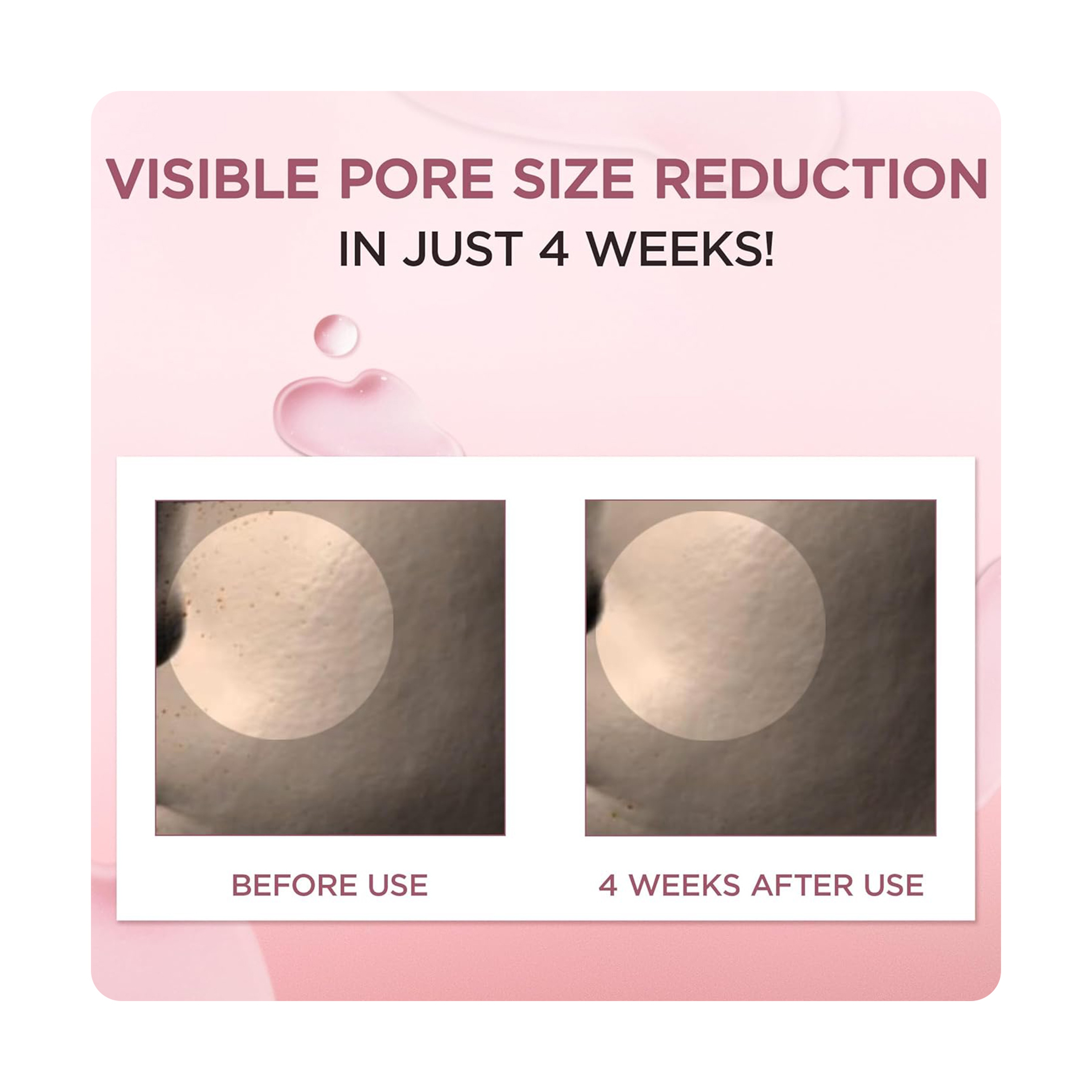 سكين1004 امبول تصغير المسام مدغشقر 100 مل