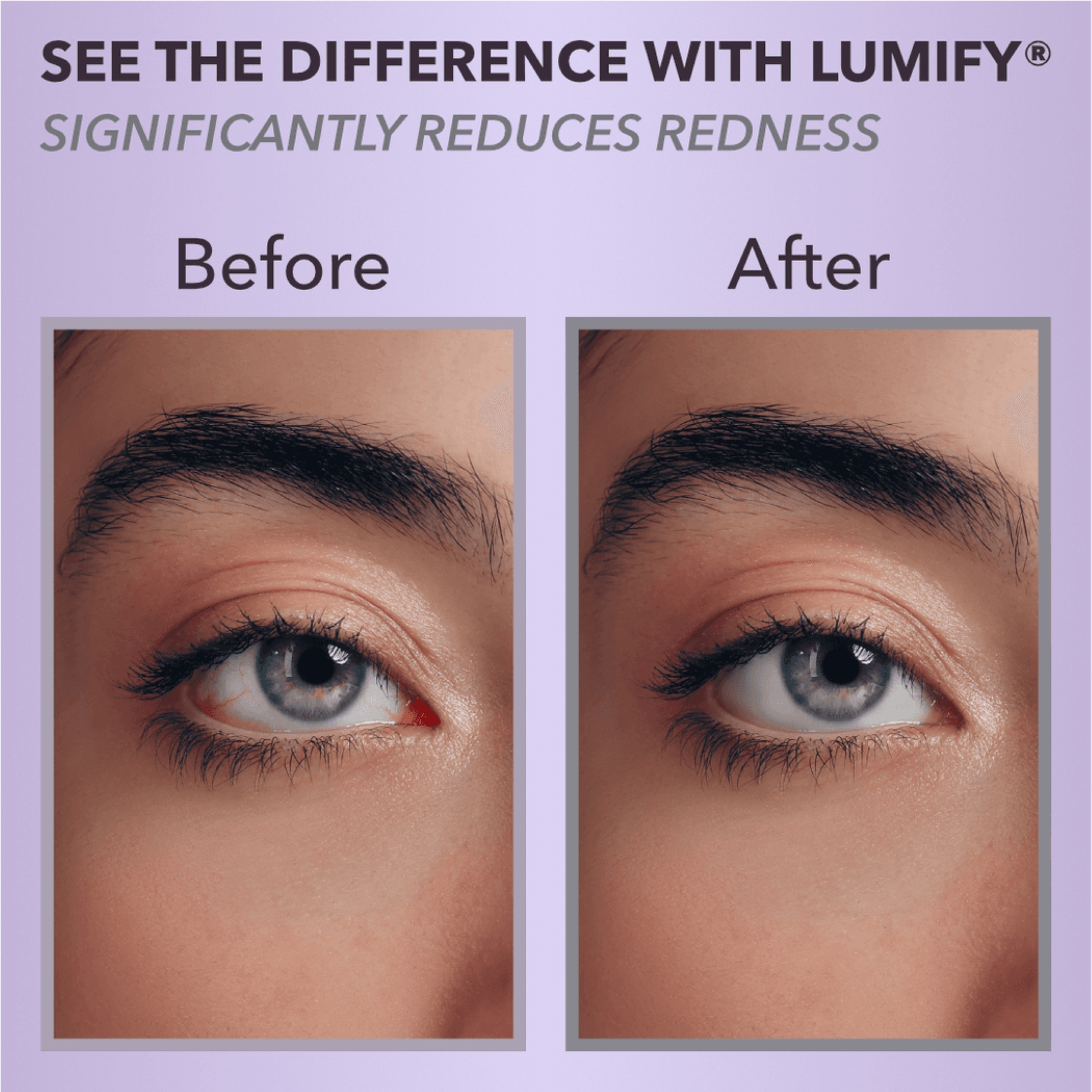 LUMIFY EYE DROPS