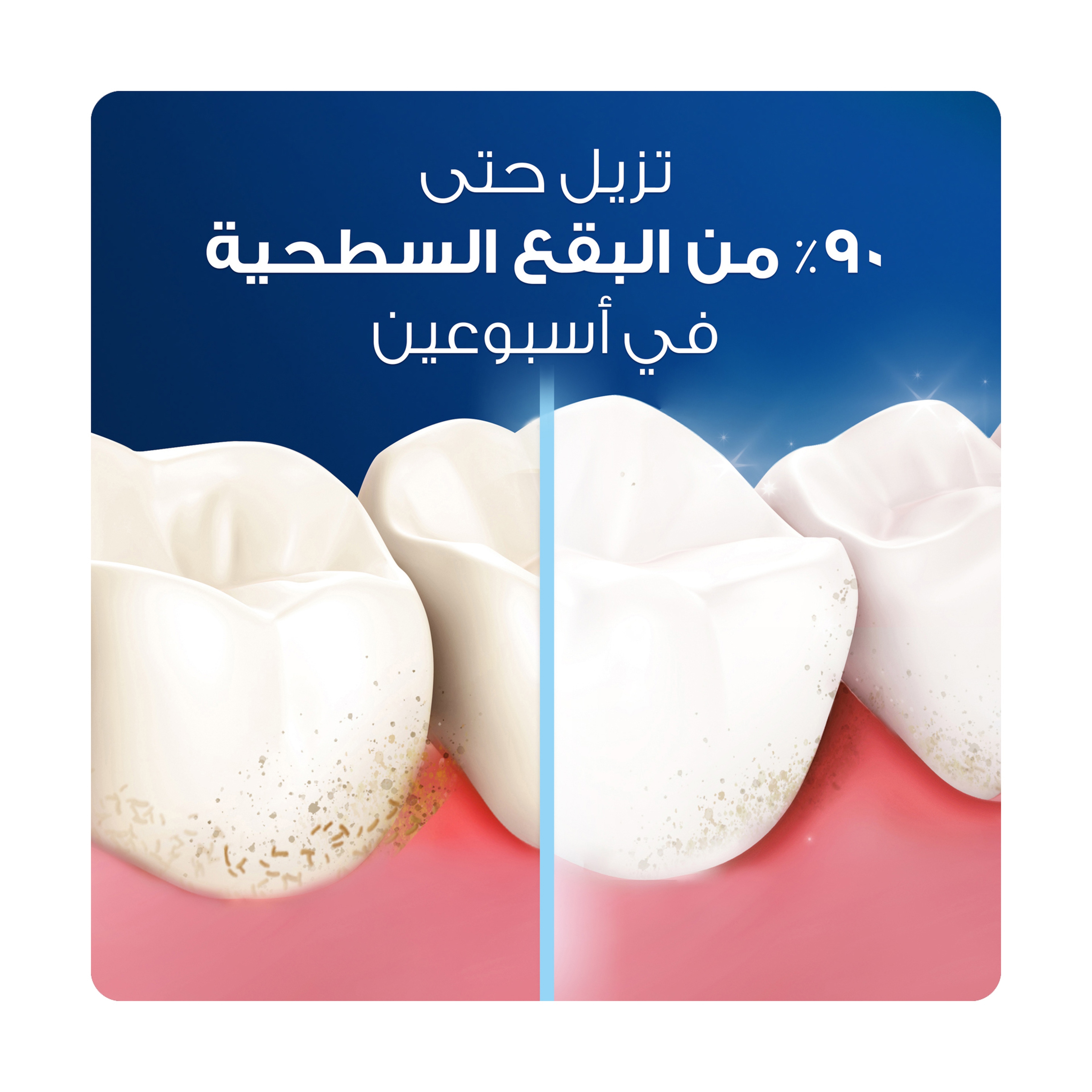 اورال بى فرشة اسنان وسط