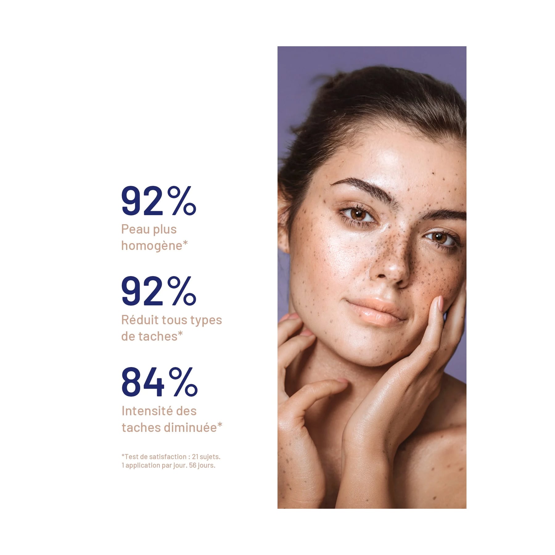Soskin Dark Spot Serum 30Ml