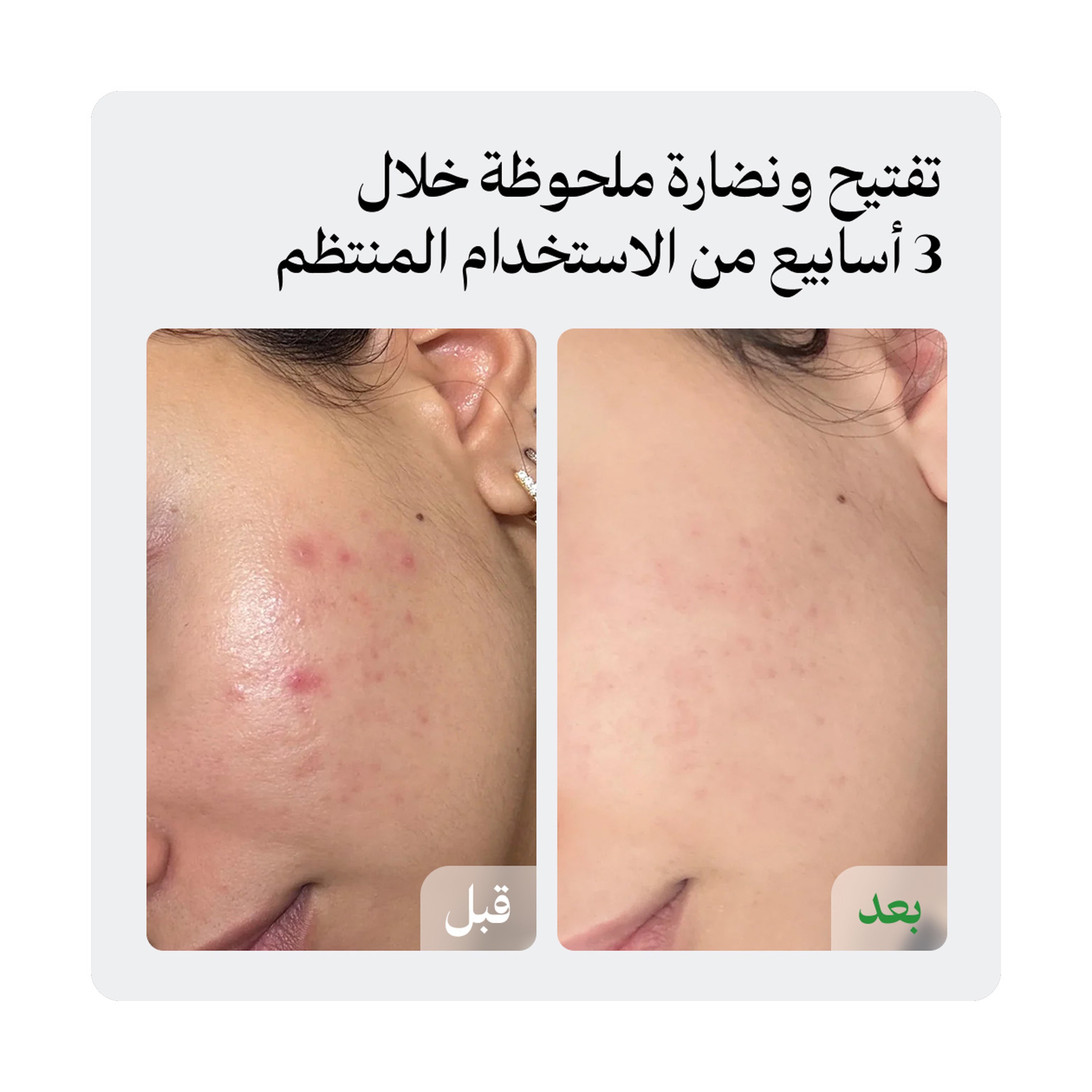 لونيل سيروم لتفتيح وإشراقة البشرة