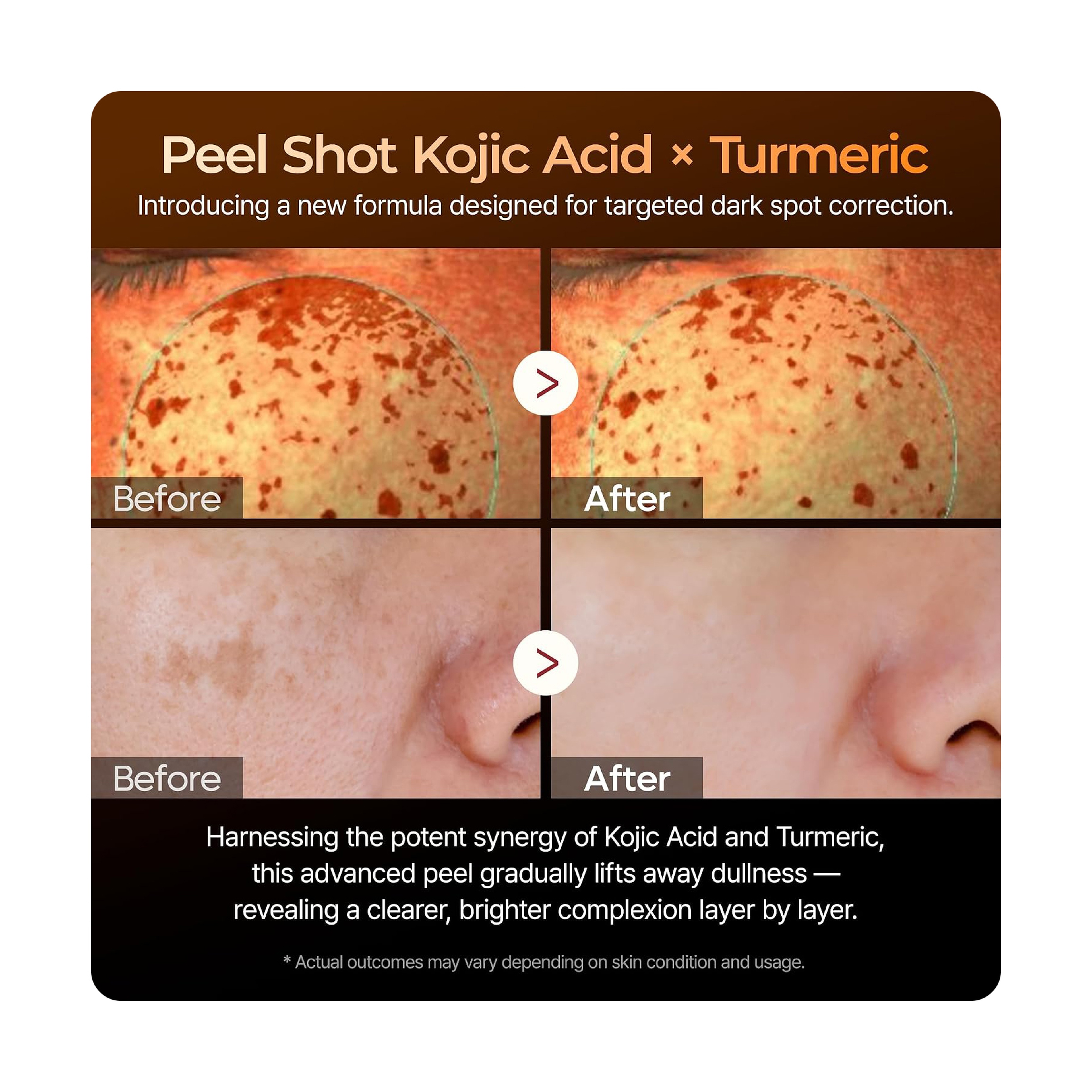 Dr.Melaxin Kojic Acid Turmeric Serum 80M